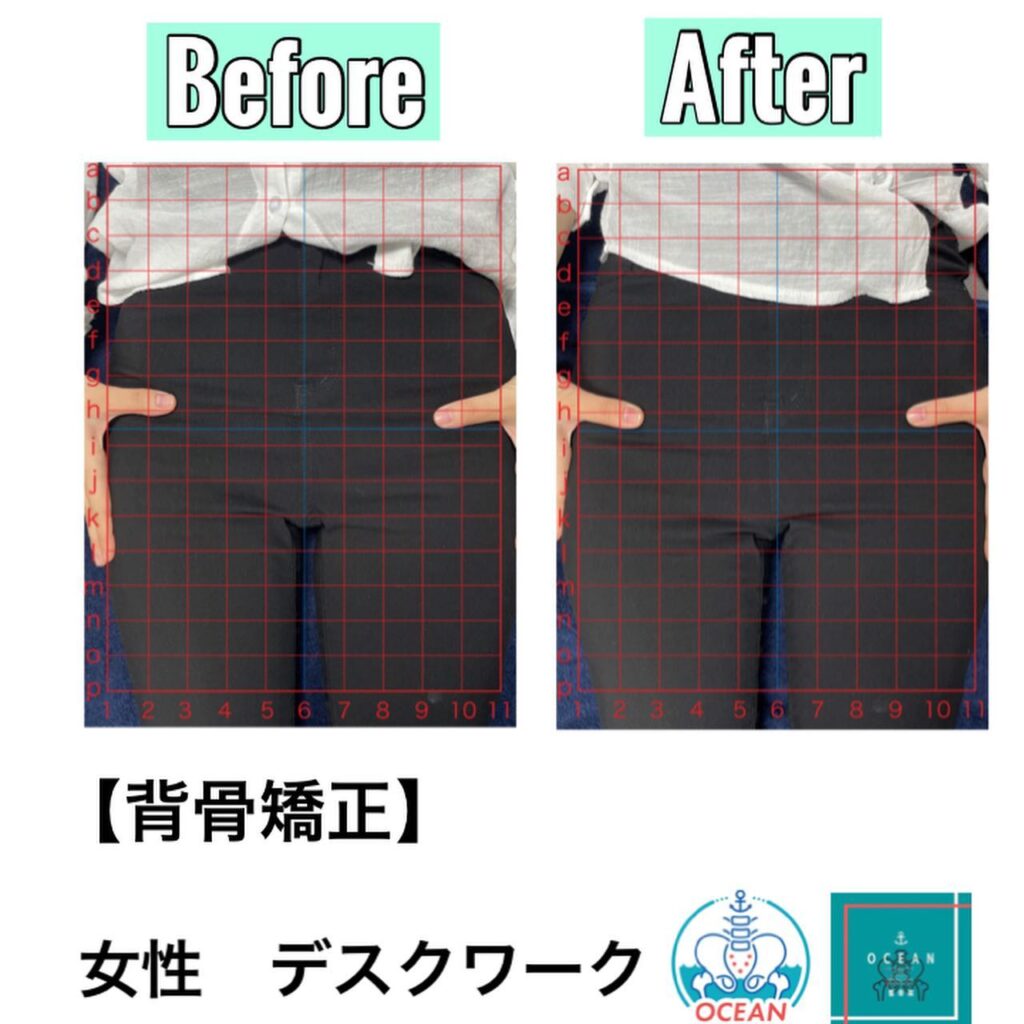 こんにちは🌞OCEAN整骨院です！OCEAN整骨院ではいろいろな方に合わせた矯正法がございます️患者様の症状や、身体の状態をしっかりと問診させていただきますまたその症状、身体の状態に合わせた施術法や施術期間・施術頻度をお伝えいたします！全体の筋肉のバランスが崩れると、姿勢も歪んでしまいますその為、あらゆる痛みを引き起こしたり、スポーツでのパフォーマンスが上がりづらかったり、怪我したりします！OCEAN整骨院ではそのようなお悩みを解決いたします姿勢矯正をされたい方は是非一度OCEAN整骨院にご相談ください‍♂️‍♀️【鹿児島で姿勢矯正するならOCEAN整骨院】8月は、有難い事にご予約が埋まっております。