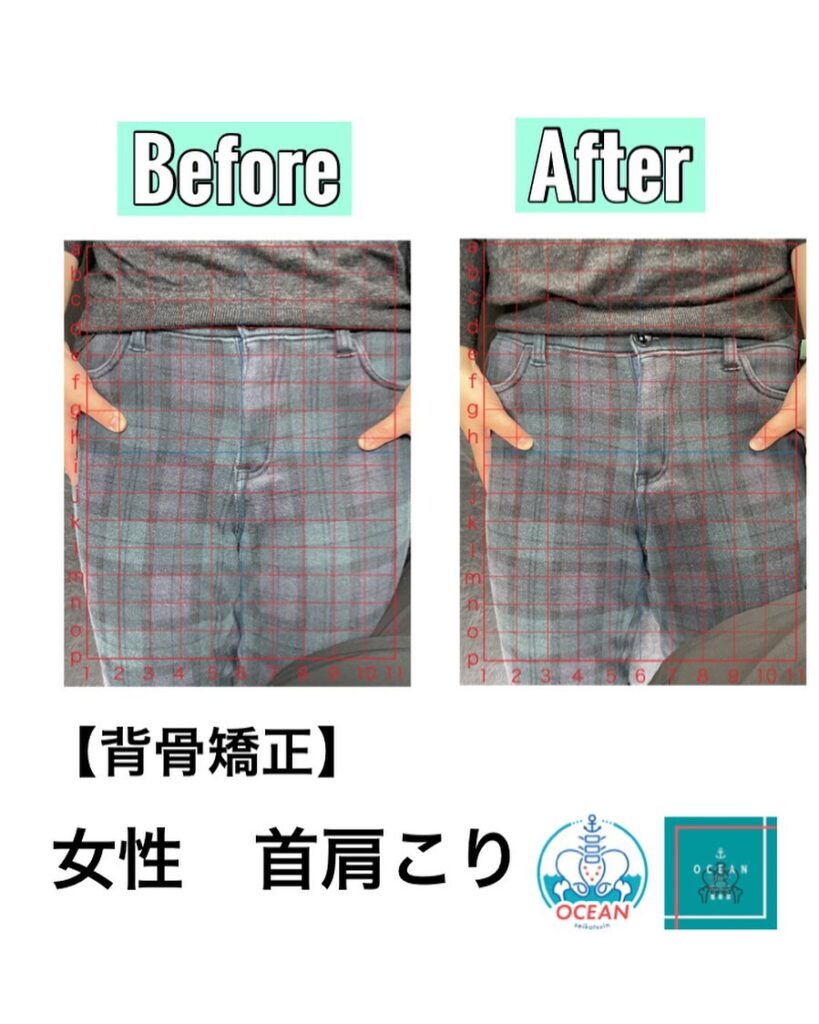 こんばんは️OCEAN整骨院です!当院で1番人気の背骨矯正です🦴「ボキッ」って音は怖い方も多いとは思いますが、基本的には全く痛くありません️どうしても怖くて力が入ってしまうと痛みを伴ってしまいます。