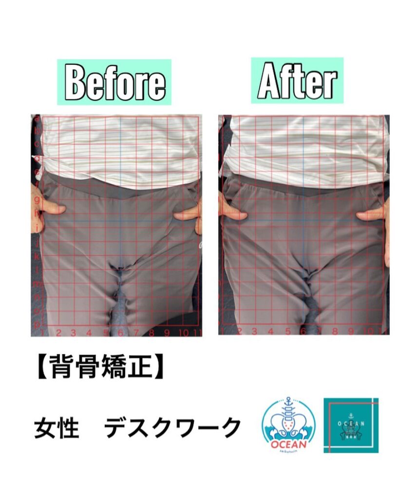 あけましておめでとうございますOCEAN整骨院です!当院で1番人気の背骨矯正です🦴「ボキッ」って音は怖い方も多いとは思いますが、基本的には全く痛くありません️どうしても怖くて力が入ってしまうと痛みを伴ってしまいます。