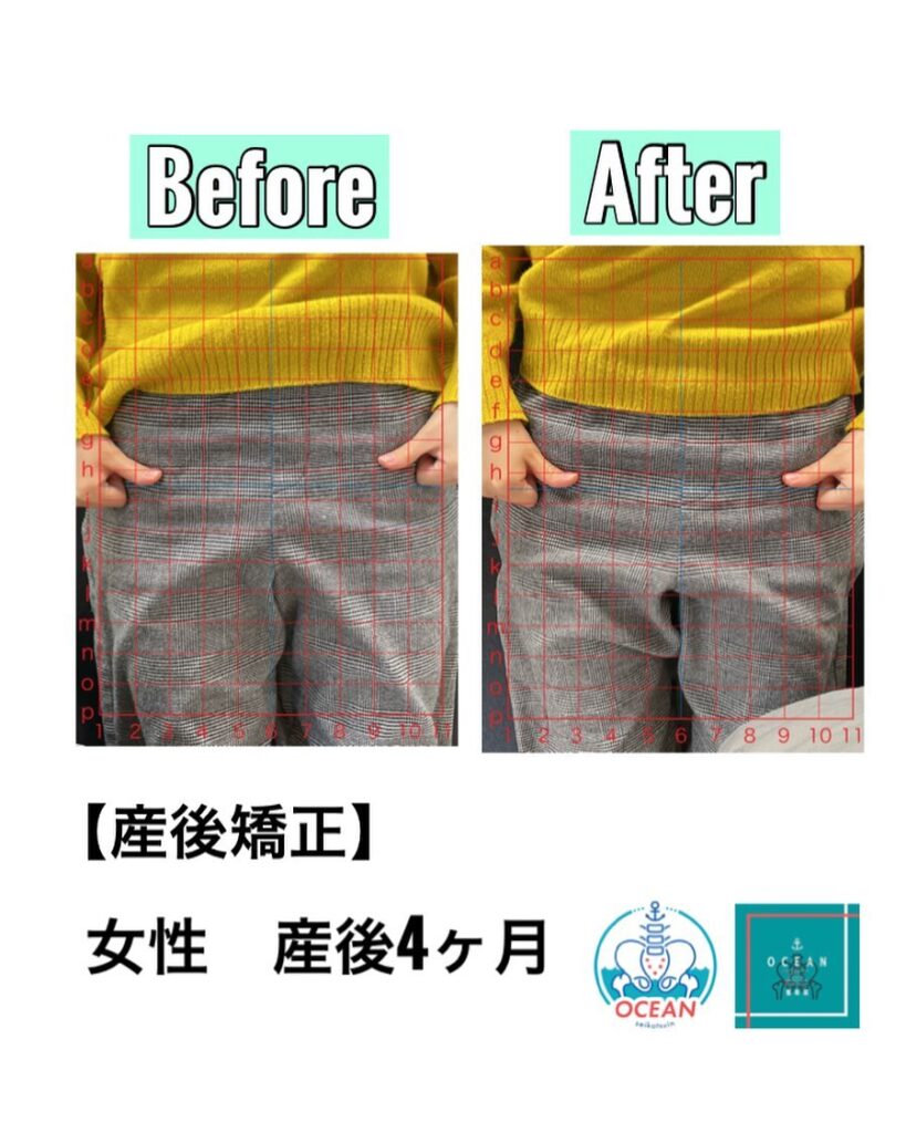 こんばんはOCEAN整骨院です！当院で1番人気の産後矯正（背骨矯正）です🦴「ボキッ」って音は怖い方も多いとは思いますが、基本的には全く痛くありません️どうしても怖くて力が入ってしまうと痛みを伴ってしまいます。