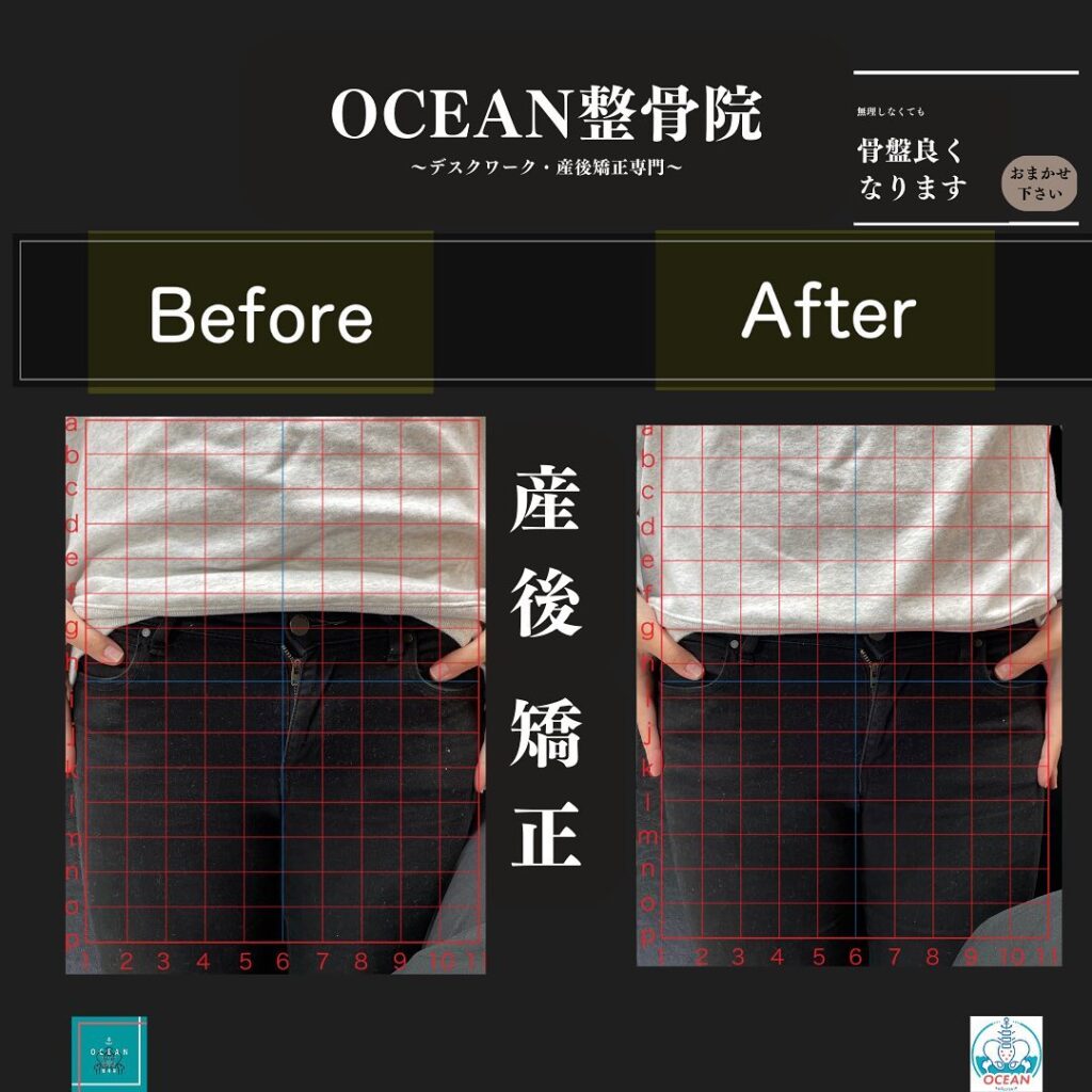 こんにちは！OCEAN整骨院です！当院の産後矯正は様々な症状やお悩みに合わせた施術となっております…🤔💭また、下記曜日、時間は産後の患者様優先時間となっております！○月曜日 9:00~13:00○金曜日9:00~13:00この時間でのご予約は託児スタッフが大事なお子様をお預かり致します※託児料は発生しません。