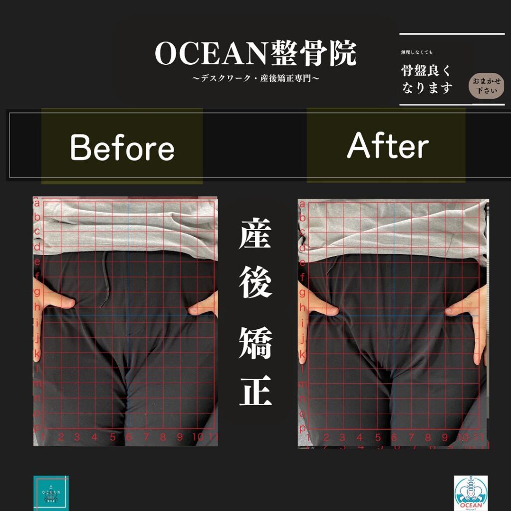 こんにちは！OCEAN整骨院です！当院の産後矯正は様々な症状やお悩みに合わせた施術となっております…🤔💭また、下記曜日、時間は産後の患者様優先時間となっております！○月曜日 9:00~13:00○金曜日9:00~13:00この時間でのご予約は託児スタッフが大事なお子様をお預かり致します※託児料は発生しません。