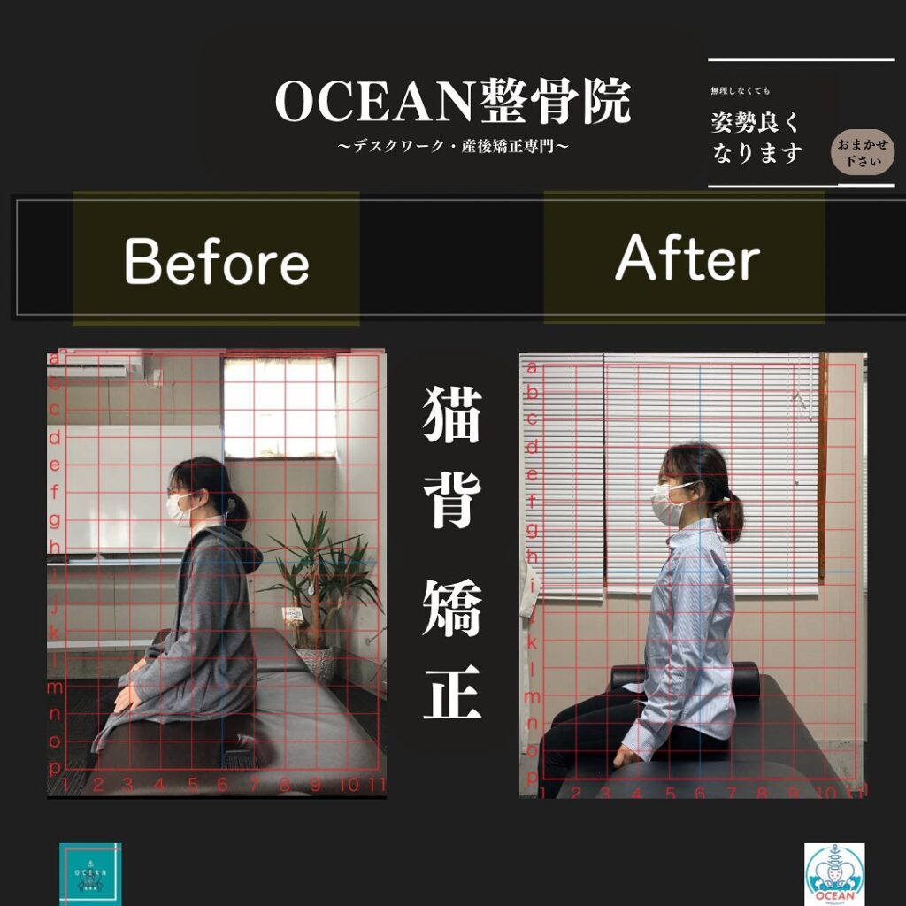 こんにちは！OCEAN整骨院です当院のOCEAN式猫背矯正は、基本的には特別なものを使っての施術や、特殊な技などを使った施術ではありませんその方その方の猫背になっている原因の筋肉や神経・関節などに対して適切にアプローチすることにより、施術終了後に患者様より、【え、今のでこんなに変わったの？！】と言われることが多々あります️特別なことをしてない分、体にも負担が少なく安心安全の施術を提供しております！痛みがなくても姿勢の治療は必要です‍♂️痛みがないからこそ姿勢の治療が必要になってきますので、気になる方はご連絡・ご予約お待ちしております※写真の方は左が初診時施術前で、右が3回目施術前となっております！3月も徐々に埋まってきておりますので、お早めのご連絡お待ちしております下記の時間を新規の方限定の時間帯にさせていただきます‍♀️①平日正午12:00~1名②平日午後18:00〜1名③土曜正午12:00〜1名④日曜正午12:00〜1名気になる方は、①インスタDMで予約②インスタ予約欄から予約③公式LINE④電話で予約️LINEに関しましては、インスタプロフィールよりハイライトにてLINEのQRコードがありますご連絡お待ちしております！𓂃𓂂𓋪𓂃𓂂𓂃𓋪𓃉𓂃ํ𓂃𓂂𓂃𓋪𓂃ํ𓂃𓂂𓂃𓂂𓋪𓂃𓃉ํ𓂃𓋪𓂂𓂃ํ𓂂𓂃𓃉𓋪❏ OCEAN整骨院︎ 鹿児島県薩摩川内市五代町1857-3︎ 営業時間: 月〜金 9時〜21時　　　　　　　　土 9時〜18時　　　　　　　　日 9時〜13時︎鹿児島で姿勢矯正・産後矯正ならOCEAN整骨院︎デスクワーク・産後矯正専門