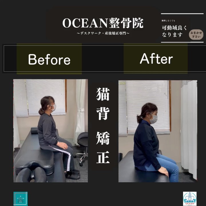 ・こんばんは！OCEAN整骨院です‍♂️肩関節周囲炎(四十肩・五十肩)の方が来院されましたbeforeが1回目の施術前で、afterが2回目の施術前となっております！正しい知識で正しく判断し丁寧に施術をすると1回だけでもこれくらい可動域が変化します今回は様々な検査をして肩関節周囲炎と判断し施術しましたが、実は肩関節周囲炎(四十肩・五十肩)と思っていても、全く別の疾患の可能性もありますそうなると治療法も全く変わってきますので、治療効果も出ません！インフルエンザにはインフルエンザの薬があるように原因が変われば施術・治療法も大きく変わります！今現在、治療院や整体で施術してるけど、なかなか症状が改善しない場合は1度ご相談下さい‍♂️また、周りにこのような症状でお悩みの方がいらっしゃいましたら、教えてあげてくださいきっとその方のお力になれると思います🥰4月もほとんど埋まってきておりますので、お早めのご連絡お待ちしております下記の時間を新規の方限定の時間帯にさせていただきます‍♀️①平日正午12:00~1名②平日午後18:00〜1名③土曜正午12:00〜1名④日曜正午12:00〜1名気になる方は、①インスタDMで予約②インスタ予約欄から予約③公式LINE④電話で予約️LINEに関しましては、インスタプロフィールよりハイライトにてLINEのQRコードがありますご連絡お待ちしております！𓂃𓂂𓋪𓂃𓂂𓂃𓋪𓃉𓂃ํ𓂃𓂂𓂃𓋪𓂃ํ𓂃𓂂𓂃𓂂𓋪𓂃𓃉ํ𓂃𓋪𓂂𓂃ํ𓂂𓂃𓃉𓋪❏ OCEAN整骨院︎ 鹿児島県薩摩川内市五代町1857-3︎ 営業時間: 月〜金 9時〜21時　　　　　　　　土 9時〜18時　　　　　　　　日 9時〜13時︎鹿児島で姿勢矯正・産後矯正ならOCEAN整骨院︎デスクワーク・産後矯正専門