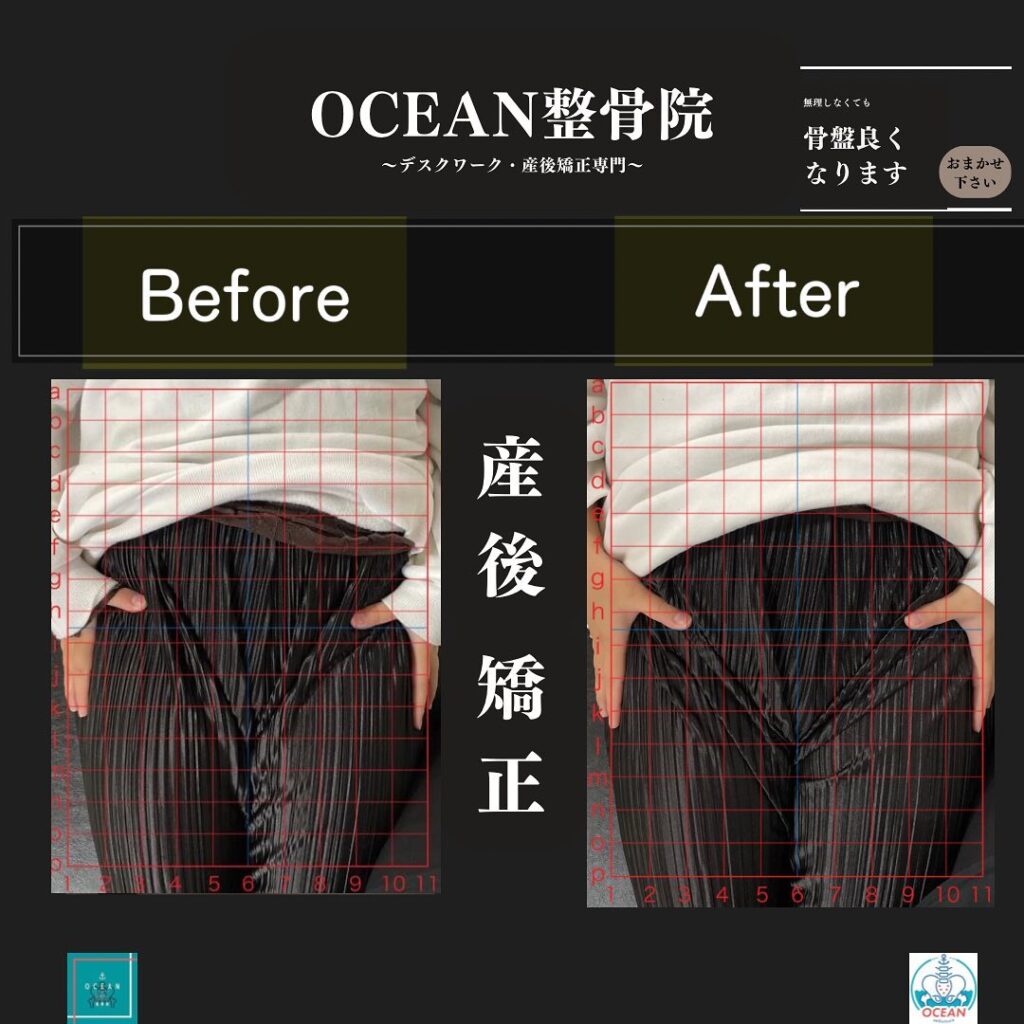 こんにちは！OCEAN整骨院です！当院の産後矯正は様々な症状やお悩みに合わせた施術となっております…🤔💭また、下記曜日、時間は産後の患者様優先時間となっております！○月曜日 9:00~13:00○金曜日9:00~13:00この時間でのご予約は託児スタッフが大事なお子様をお預かり致します※託児料は発生しません。
