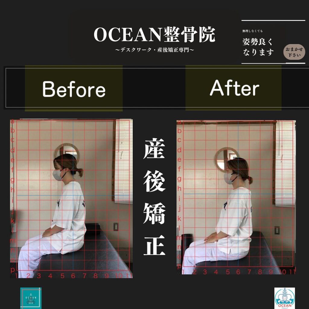 こんばんはOCEAN整骨院です！当院の産後矯正は様々な症状やお悩みに合わせた施術となっております…🤔💭産後矯正で行う背骨矯正は骨盤のみならず姿勢もしっかり整います‍♂️また、下記曜日、時間は産後の患者様優先時間となっております！○月曜日 9:00~13:00○金曜日9:00~13:00この時間でのご予約は託児スタッフが大事なお子様をお預かり致します※託児料は発生しません。