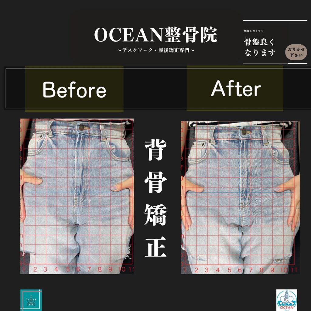 こんにちは！OCEAN整骨院です!当院で1番人気の背骨矯正です🦴「ボキッ」って音は怖い方も多いとは思いますが、基本的には全く痛くありません️どうしても怖くて力が入ってしまうと痛みを伴ってしまいます。