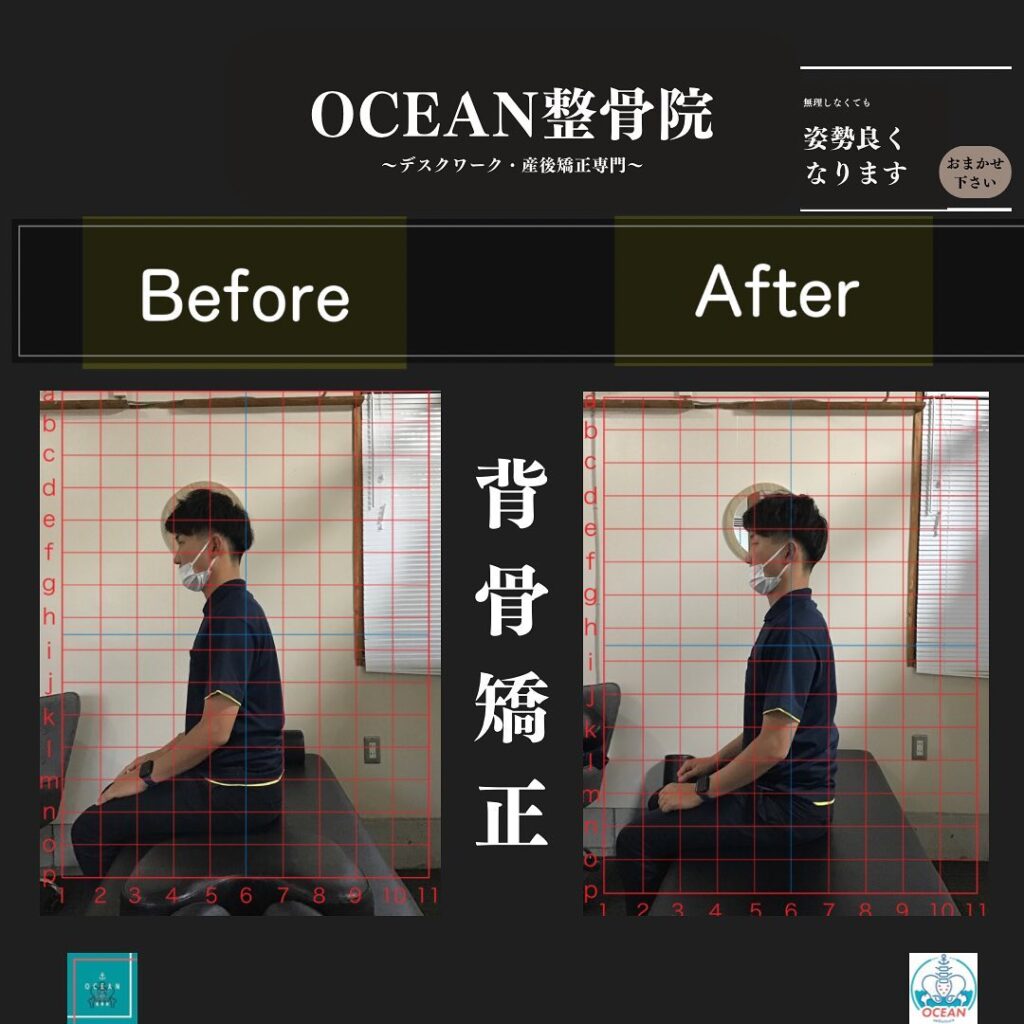 こんにちは！OCEAN整骨院です!当院で1番人気の背骨矯正です🦴「ボキッ」って音は怖い方も多いとは思いますが、基本的には全く痛くありません️どうしても怖くて力が入ってしまうと痛みを伴ってしまいます。