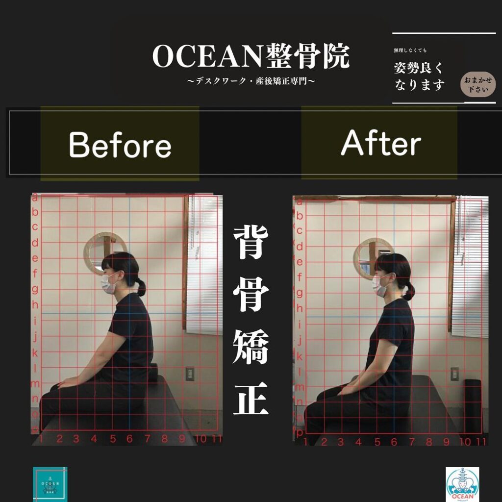 こんにちは！OCEAN整骨院です!当院で1番人気の背骨矯正です🦴「ボキッ」って音は怖い方も多いとは思いますが、基本的には全く痛くありません️どうしても怖くて力が入ってしまうと痛みを伴ってしまいます。