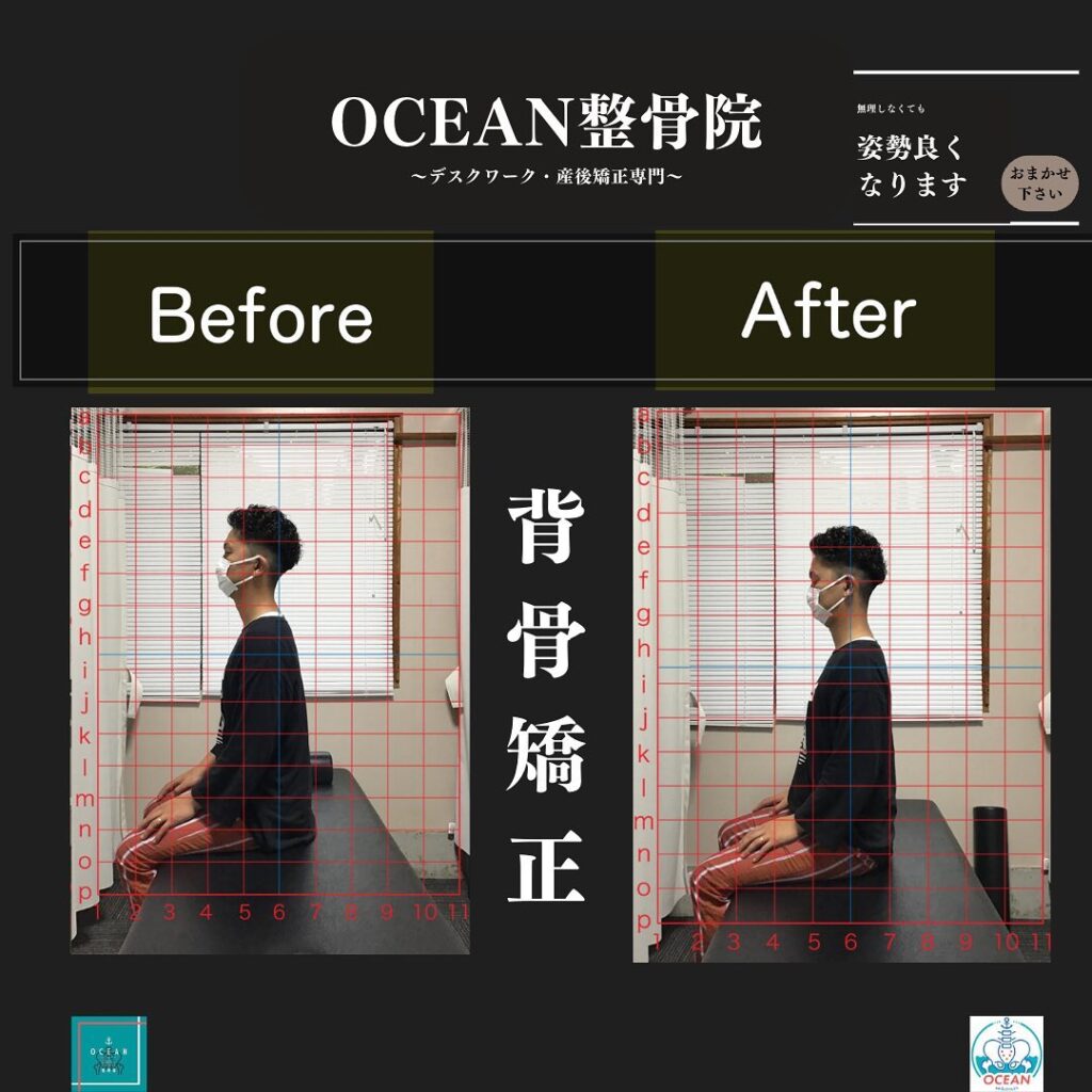 こんにちは！OCEAN整骨院です!当院で1番人気の背骨矯正です🦴「ボキッ」って音は怖い方も多いとは思いますが、基本的には全く痛くありません️どうしても怖くて力が入ってしまうと痛みを伴ってしまいます。