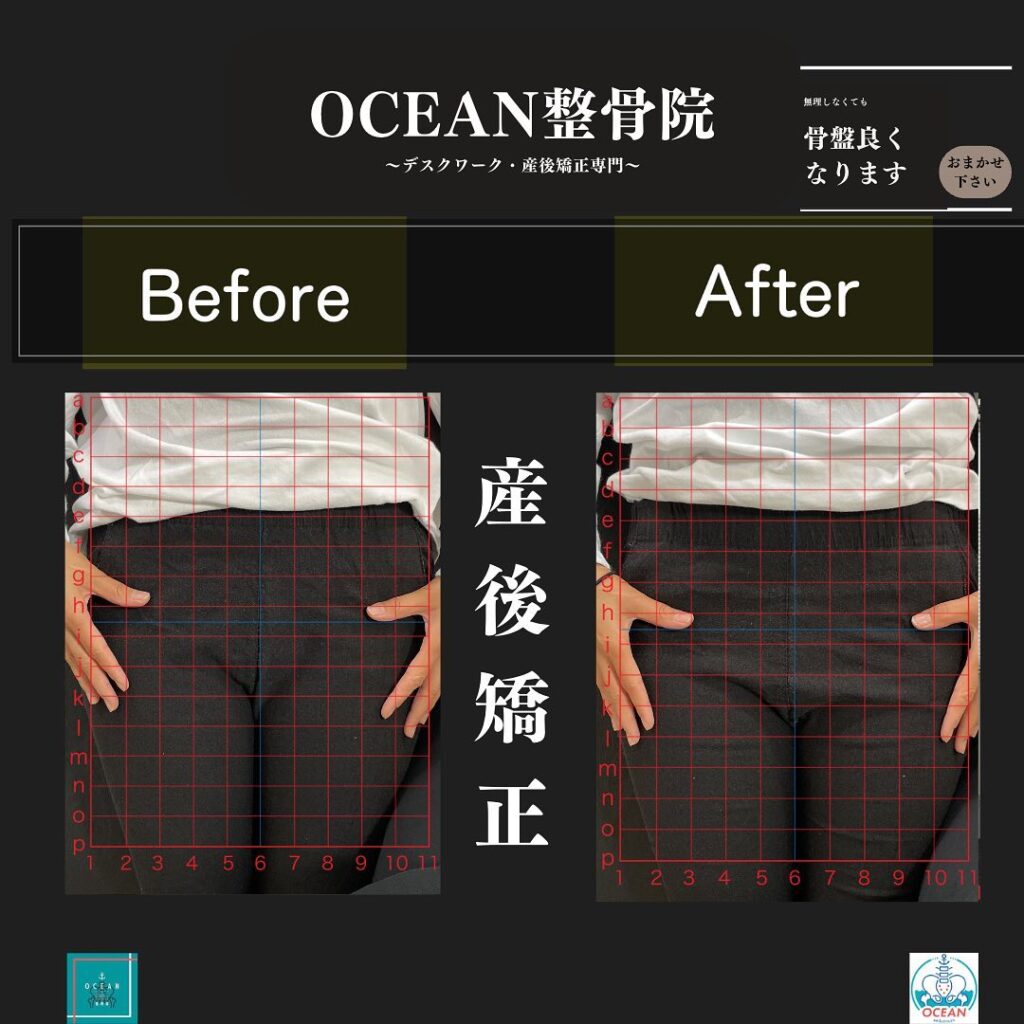 こんばんはOCEAN整骨院です！当院の産後矯正は様々な症状やお悩みに合わせた施術となっております…🤔💭家族や友達、仕事の上司、同期や後輩で体の不調でお困りの方がいらっしゃいましたら、是非ご紹介下さいきっとお力になれると思います🤝その他施術についてや、分からないこと等あればいつでもご連絡お待ちしております‍♂️‍♀️下記の時間を新規の方限定の時間帯にさせていただきます‍♀️①平日正午12:00~1名②平日午後18:00〜1名③土曜正午12:00〜1名④日曜正午12:00〜1名下記曜日、時間は産後の患者様優先時間となっております！○月曜日 9:00~13:00○金曜日9:00~13:00この時間でのご予約は託児スタッフが大事なお子様をお預かり致します※託児料は発生しません。