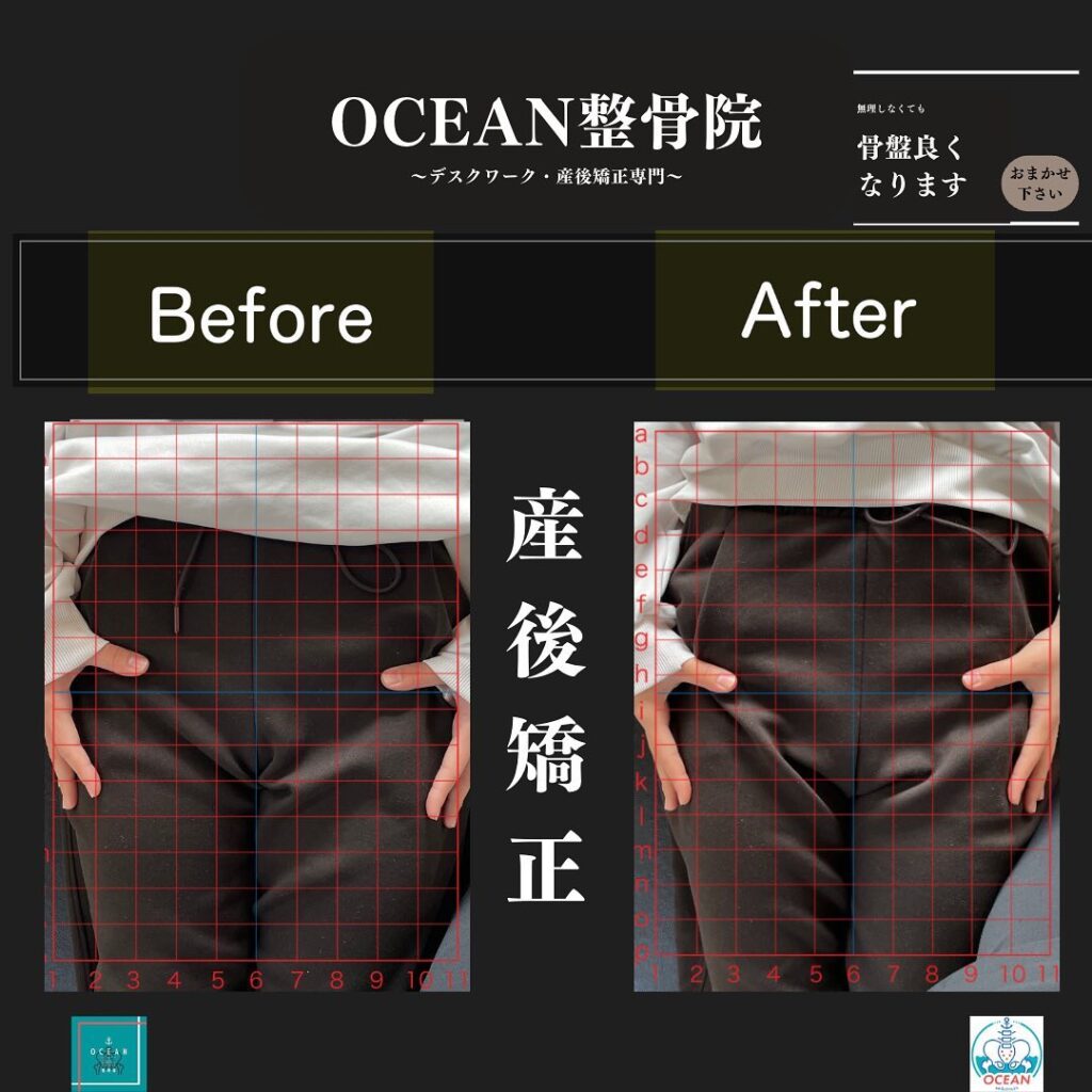 こんばんはOCEAN整骨院です！当院の産後矯正は様々な症状やお悩みに合わせた施術となっております…🤔💭家族や友達、仕事の上司、同期や後輩で体の不調でお困りの方がいらっしゃいましたら、是非ご紹介下さいきっとお力になれると思います🤝その他施術についてや、分からないこと等あればいつでもご連絡お待ちしております‍♂️‍♀️下記の時間を新規の方限定の時間帯にさせていただきます‍♀️①平日正午12:00~1名②平日午後18:00〜1名③土曜正午12:00〜1名④日曜正午12:00〜1名下記曜日、時間は産後の患者様優先時間となっております！○月曜日 9:00~13:00○金曜日9:00~13:00この時間でのご予約は託児スタッフが大事なお子様をお預かり致します※託児料は発生しません。
