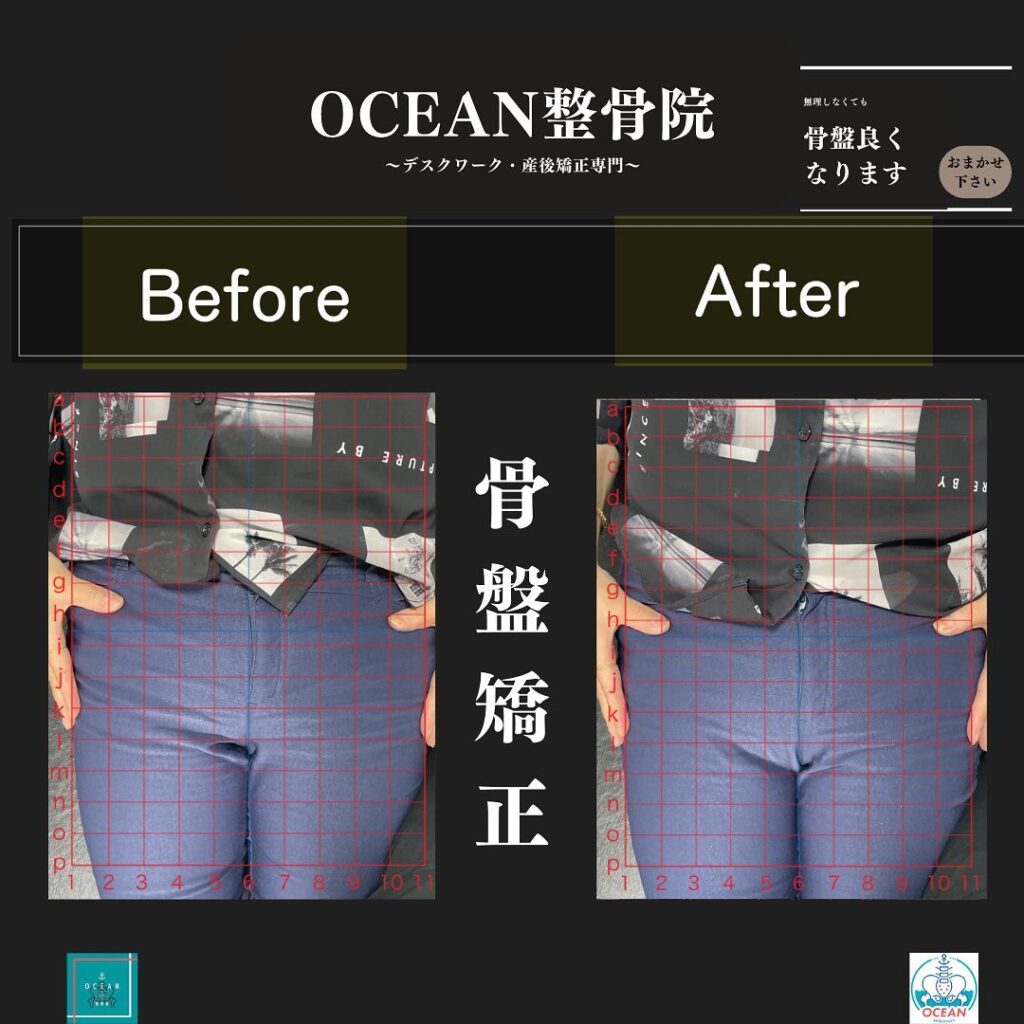 こんにちは！OCEAN整骨院です!当院で1番人気の背骨矯正です🦴「ボキッ」って音は怖い方も多いとは思いますが、基本的には全く痛くありません️どうしても怖くて力が入ってしまうと痛みを伴ってしまいます。