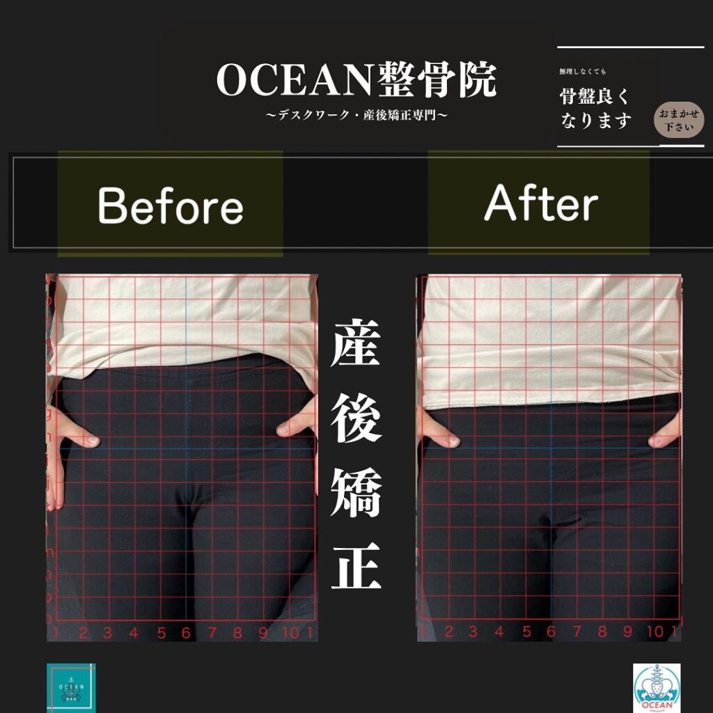 こんばんはOCEAN整骨院です！当院の産後矯正は様々な症状やお悩みに合わせた施術となっております…🤔💭家族や友達、仕事の上司、同期や後輩で体の不調でお困りの方がいらっしゃいましたら、是非ご紹介下さいきっとお力になれると思います🤝その他施術についてや、分からないこと等あればいつでもご連絡お待ちしております‍♂️‍♀️下記の時間を新規の方限定の時間帯にさせていただきます‍♀️①平日正午12:00~1名②平日午後18:00〜1名③土曜正午12:00〜1名④日曜正午12:00〜1名下記曜日、時間は産後の患者様優先時間となっております！○月曜日 9:00~13:00○金曜日9:00~13:00この時間でのご予約は託児スタッフが大事なお子様をお預かり致します※託児料は発生しません。