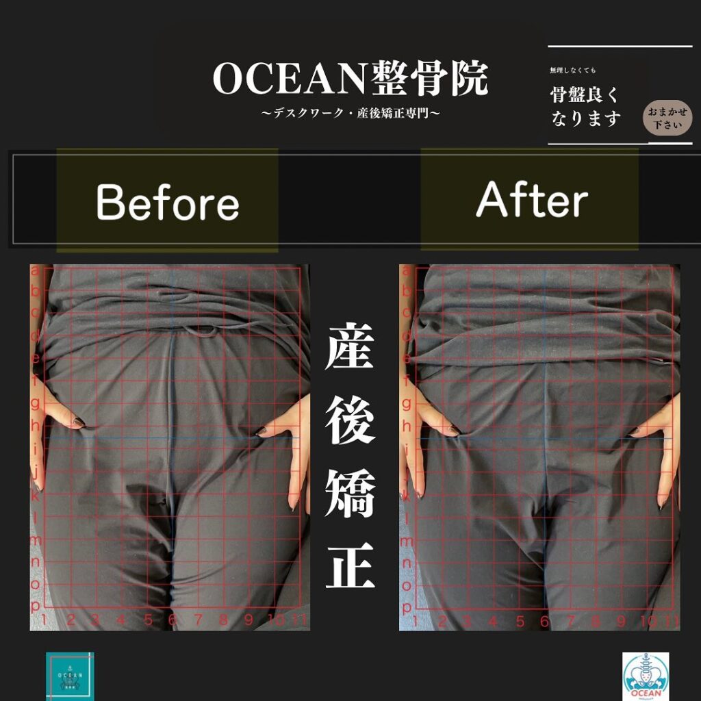 こんばんはOCEAN整骨院です！当院の産後矯正は様々な症状やお悩みに合わせた施術となっております…🤔💭家族や友達、仕事の上司、同期や後輩で体の不調でお困りの方がいらっしゃいましたら、是非ご紹介下さいきっとお力になれると思います🤝その他施術についてや、分からないこと等あればいつでもご連絡お待ちしております‍♂️‍♀️下記の時間を新規の方限定の時間帯にさせていただきます‍♀️①平日正午12:00~1名②平日午後18:00〜1名③土曜正午12:00〜1名④日曜正午12:00〜1名下記曜日、時間は産後の患者様優先時間となっております！○月曜日 9:00~13:00○金曜日9:00~13:00この時間でのご予約は託児スタッフが大事なお子様をお預かり致します※託児料は発生しません。