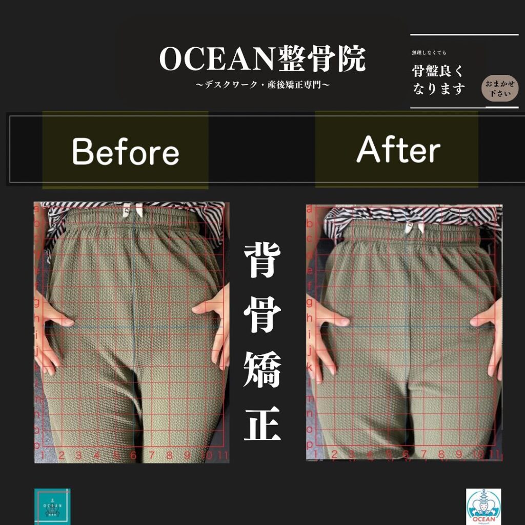 こんにちは！OCEAN整骨院です!当院で1番人気の背骨矯正です🦴「ボキッ」って音は怖い方も多いとは思いますが、基本的には全く痛くありません️どうしても怖くて力が入ってしまうと痛みを伴ってしまいます。