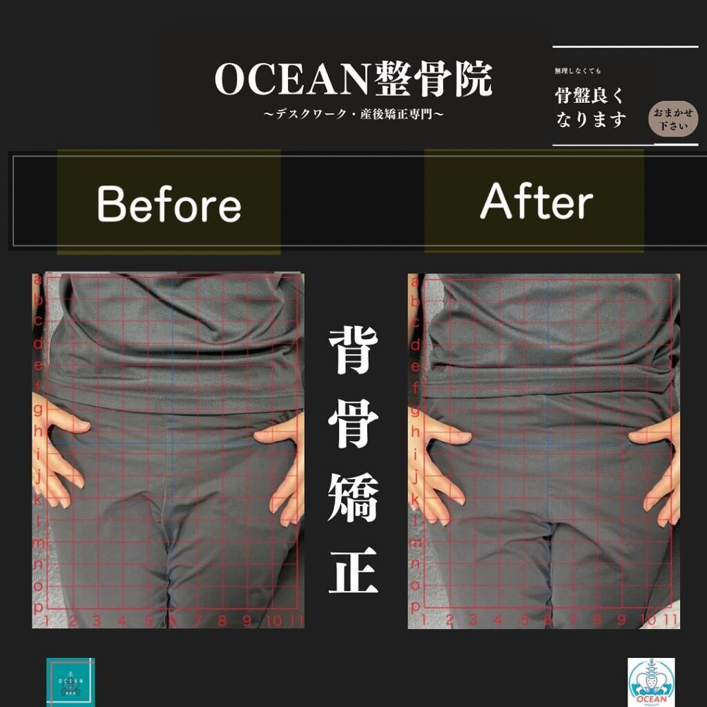 こんにちは！OCEAN整骨院です!当院で1番人気の背骨矯正です🦴「ボキッ」って音は怖い方も多いとは思いますが、基本的には全く痛くありません️どうしても怖くて力が入ってしまうと痛みを伴ってしまいます。