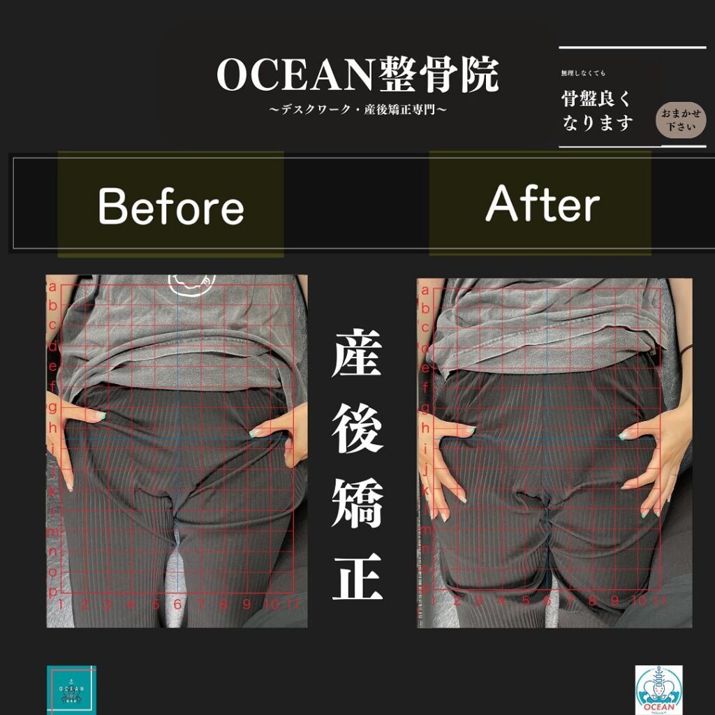 こんばんはOCEAN整骨院です！当院の産後矯正は様々な症状やお悩みに合わせた施術となっております…🤔💭家族や友達、仕事の上司、同期や後輩で体の不調でお困りの方がいらっしゃいましたら、是非ご紹介下さいきっとお力になれると思います🤝その他施術についてや、分からないこと等あればいつでもご連絡お待ちしております‍♂️‍♀️下記の時間を新規の方限定の時間帯にさせていただきます‍♀️①平日正午12:00~1名②平日午後18:00〜1名③土曜正午12:00〜1名④日曜正午12:00〜1名下記曜日、時間は産後の患者様優先時間となっております！○月曜日 9:00~13:00○金曜日9:00~13:00この時間でのご予約は託児スタッフが大事なお子様をお預かり致します※託児料は発生しません。