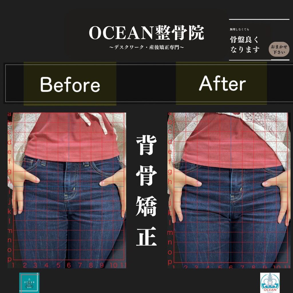 こんにちは！OCEAN整骨院です!当院で1番人気の背骨矯正です🦴「ボキッ」って音は怖い方も多いとは思いますが、基本的には全く痛くありません️どうしても怖くて力が入ってしまうと痛みを伴ってしまいます。