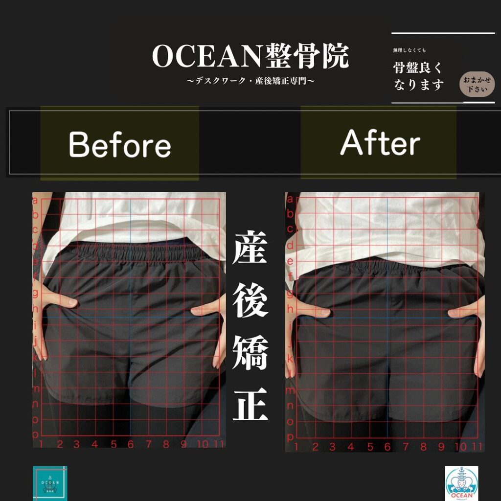 こんばんはOCEAN整骨院です！当院の産後矯正は様々な症状やお悩みに合わせた施術となっております…🤔💭家族や友達、仕事の上司、同期や後輩で体の不調でお困りの方がいらっしゃいましたら、是非ご紹介下さいきっとお力になれると思います🤝その他施術についてや、分からないこと等あればいつでもご連絡お待ちしております‍♂️‍♀️下記の時間を新規の方限定の時間帯にさせていただきます‍♀️①平日正午12:00~1名②平日午後18:00〜1名③土曜正午12:00〜1名④日曜正午12:00〜1名下記曜日、時間は産後の患者様優先時間となっております！○月曜日 9:00~13:00○金曜日9:00~13:00この時間でのご予約は託児スタッフが大事なお子様をお預かり致します※託児料は発生しません。