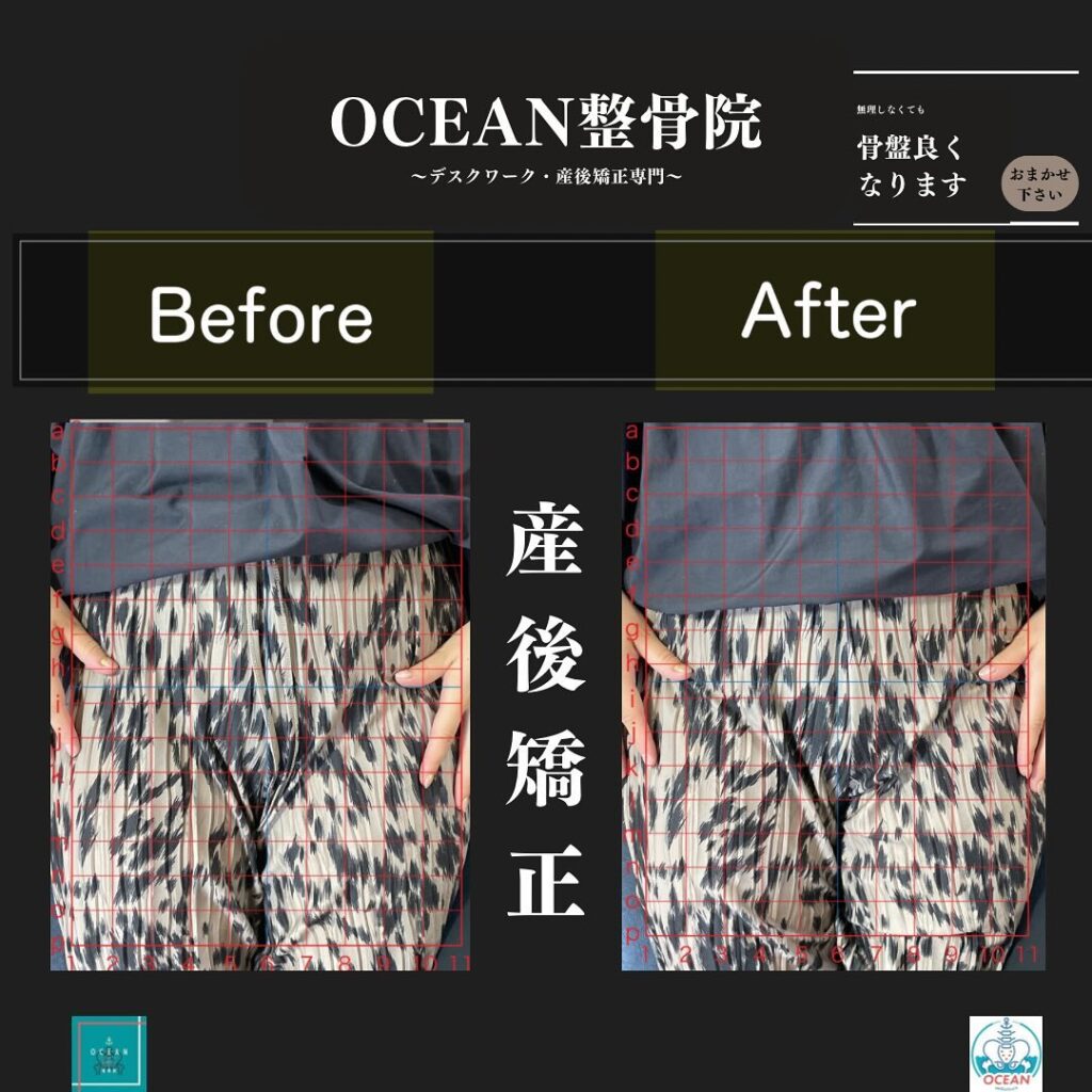 こんばんはOCEAN整骨院です！当院の産後矯正は様々な症状やお悩みに合わせた施術となっております…🤔💭家族や友達、仕事の上司、同期や後輩で体の不調でお困りの方がいらっしゃいましたら、是非ご紹介下さいきっとお力になれると思います🤝その他施術についてや、分からないこと等あればいつでもご連絡お待ちしております‍♂️‍♀️下記の時間を新規の方限定の時間帯にさせていただきます‍♀️①平日正午12:00~1名②平日午後18:00〜1名③土曜正午12:00〜1名④日曜正午12:00〜1名下記曜日、時間は産後の患者様優先時間となっております！○月曜日 9:00~13:00○金曜日9:00~13:00この時間でのご予約は託児スタッフが大事なお子様をお預かり致します※託児料は発生しません。