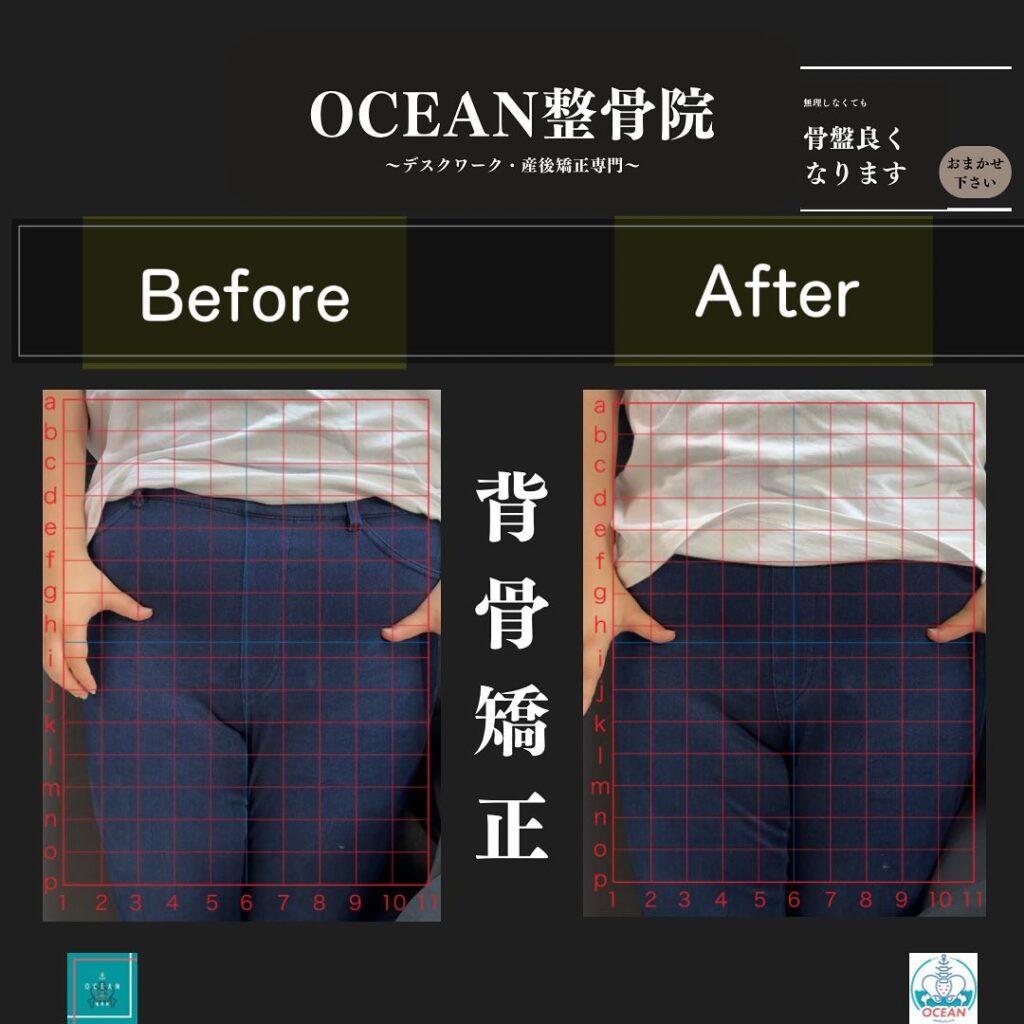 こんにちは！OCEAN整骨院です!当院で1番人気の背骨矯正です🦴「ボキッ」って音は怖い方も多いとは思いますが、基本的には全く痛くありません️どうしても怖くて力が入ってしまうと痛みを伴ってしまいます。