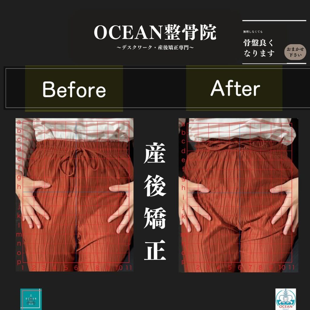 こんばんはOCEAN整骨院です！当院の産後矯正は様々な症状やお悩みに合わせた施術となっております…🤔💭家族や友達、仕事の上司、同期や後輩で体の不調でお困りの方がいらっしゃいましたら、是非ご紹介下さいきっとお力になれると思います🤝その他施術についてや、分からないこと等あればいつでもご連絡お待ちしております‍♂️‍♀️下記の時間を新規の方限定の時間帯にさせていただきます‍♀️①平日正午12:00~1名②平日午後18:00〜1名③土曜正午12:00〜1名④日曜正午12:00〜1名下記曜日、時間は産後の患者様優先時間となっております！○月曜日 9:00~13:00○金曜日9:00~13:00この時間でのご予約は託児スタッフが大事なお子様をお預かり致します※託児料は発生しません。