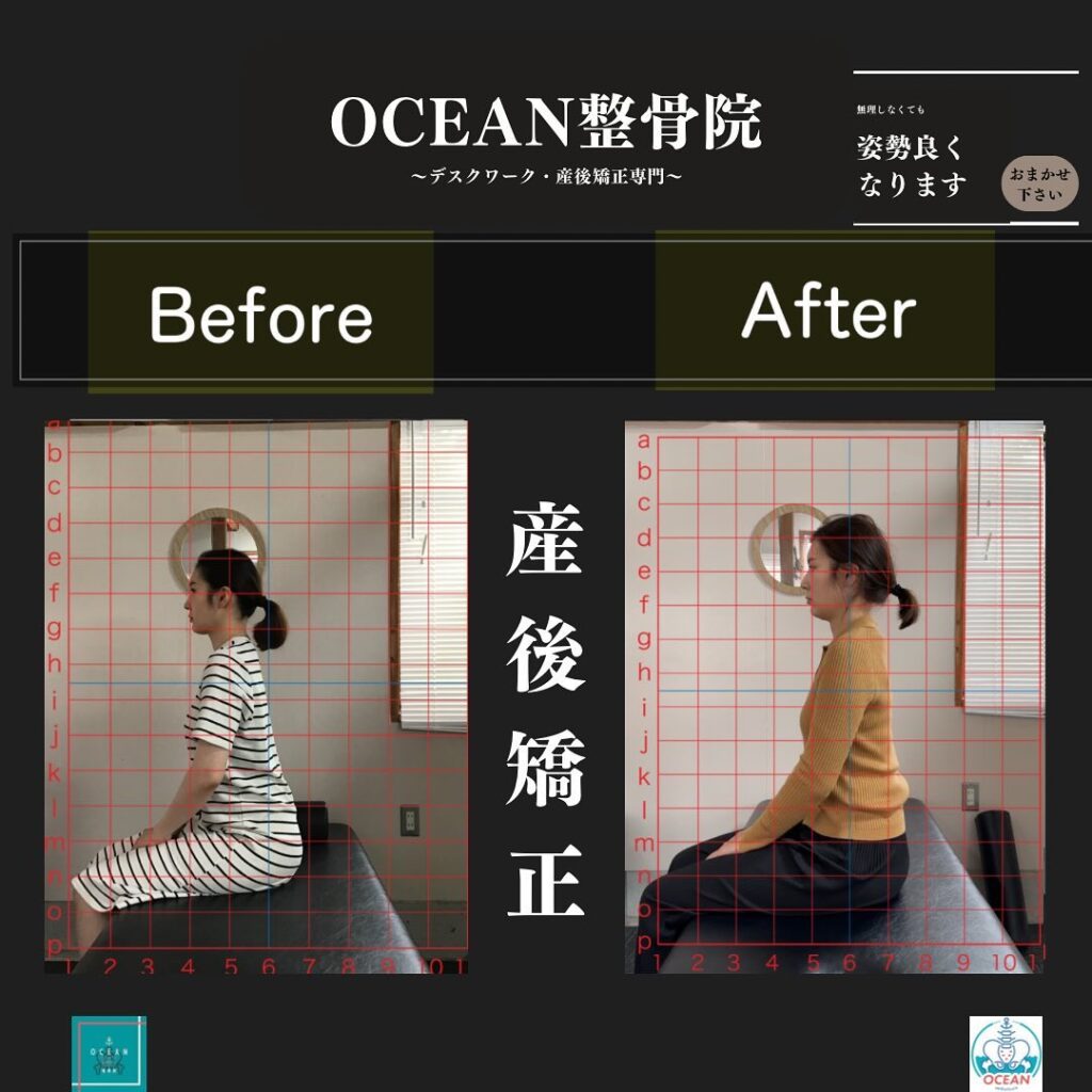 こんばんはOCEAN整骨院です！産後矯正は骨盤はもちろん姿勢の改善も期待できます当院の産後矯正は様々な症状やお悩みに合わせた施術となっております…🤔💭家族や友達、仕事の上司、同期や後輩で体の不調でお困りの方がいらっしゃいましたら、是非ご紹介下さいきっとお力になれると思います🤝その他施術についてや、分からないこと等あればいつでもご連絡お待ちしております‍♂️‍♀️下記の時間を新規の方限定の時間帯にさせていただきます‍♀️①平日正午12:00~1名②平日午後18:00〜1名③土曜正午12:00〜1名④日曜正午12:00〜1名下記曜日、時間は産後の患者様優先時間となっております！○月曜日 9:00~13:00○金曜日9:00~13:00この時間でのご予約は託児スタッフが大事なお子様をお預かり致します※託児料は発生しません。