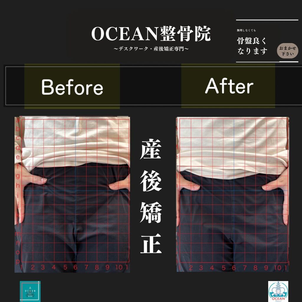 こんばんはOCEAN整骨院です！当院の産後矯正は様々な症状やお悩みに合わせた施術となっております…🤔💭家族や友達、仕事の上司、同期や後輩で体の不調でお困りの方がいらっしゃいましたら、是非ご紹介下さいきっとお力になれると思います🤝その他施術についてや、分からないこと等あればいつでもご連絡お待ちしております‍♂️‍♀️下記の時間を新規の方限定の時間帯にさせていただきます‍♀️①平日正午12:00~1名②平日午後18:00〜1名③土曜正午12:00〜1名④日曜正午12:00〜1名下記曜日、時間は産後の患者様優先時間となっております！○月曜日 9:00~13:00○金曜日9:00~13:00この時間でのご予約は託児スタッフが大事なお子様をお預かり致します※託児料は発生しません。