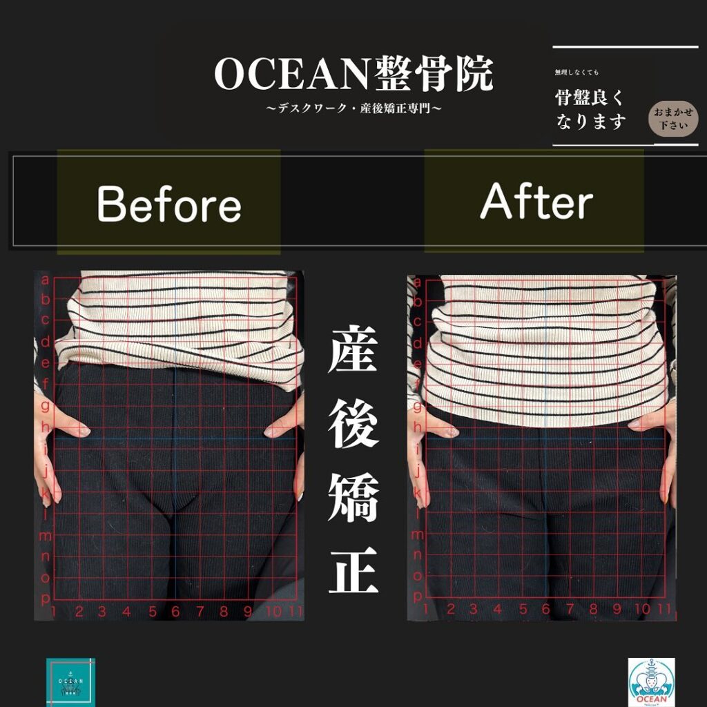 こんばんはOCEAN整骨院です！当院の産後矯正は様々な症状やお悩みに合わせた施術となっております…🤔💭家族や友達、仕事の上司、同期や後輩で体の不調でお困りの方がいらっしゃいましたら、是非ご紹介下さいきっとお力になれると思います🤝その他施術についてや、分からないこと等あればいつでもご連絡お待ちしております‍♂️‍♀️下記の時間を新規の方限定の時間帯にさせていただきます‍♀️①平日正午12:00~1名②平日午後18:00〜1名③土曜正午12:00〜1名④日曜正午12:00〜1名下記曜日、時間は産後の患者様優先時間となっております！○月曜日 9:00~13:00○金曜日9:00~13:00この時間でのご予約は託児スタッフが大事なお子様をお預かり致します※託児料は発生しません。