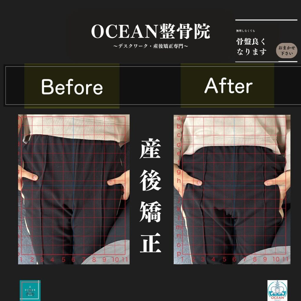 こんばんはOCEAN整骨院です！当院の産後矯正は様々な症状やお悩みに合わせた施術となっております…🤔💭家族や友達、仕事の上司、同期や後輩で体の不調でお困りの方がいらっしゃいましたら、是非ご紹介下さいきっとお力になれると思います🤝その他施術についてや、分からないこと等あればいつでもご連絡お待ちしております‍♂️‍♀️下記の時間を新規の方限定の時間帯にさせていただきます‍♀️①平日正午12:00~1名②平日午後18:00〜1名③土曜正午12:00〜1名④日曜正午12:00〜1名下記曜日、時間は産後の患者様優先時間となっております！○月曜日 9:00~13:00○金曜日9:00~13:00この時間でのご予約は託児スタッフが大事なお子様をお預かり致します※託児料は発生しません。