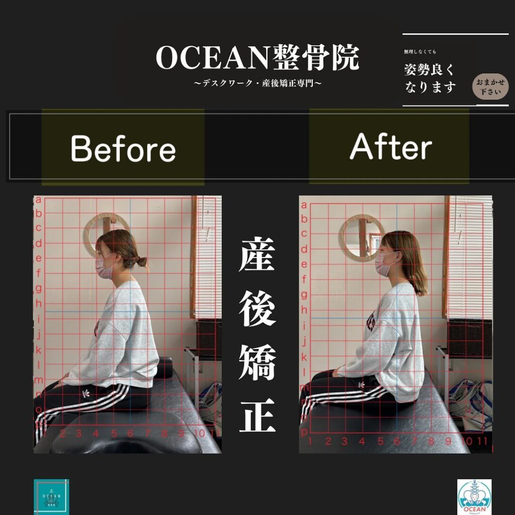 こんばんはOCEAN整骨院です！当院の産後矯正は様々な症状やお悩みに合わせた施術となっております…🤔💭家族や友達、仕事の上司、同期や後輩で体の不調でお困りの方がいらっしゃいましたら、是非ご紹介下さいきっとお力になれると思います🤝その他施術についてや、分からないこと等あればいつでもご連絡お待ちしております‍♂️‍♀️下記の時間を新規の方限定の時間帯にさせていただきます‍♀️①平日正午12:00~1名②平日午後18:00〜1名③土曜正午12:00〜1名④日曜正午12:00〜1名下記曜日、時間は産後の患者様優先時間となっております！○月曜日 9:00~13:00○金曜日9:00~13:00この時間でのご予約は託児スタッフが大事なお子様をお預かり致します※託児料は発生しません。