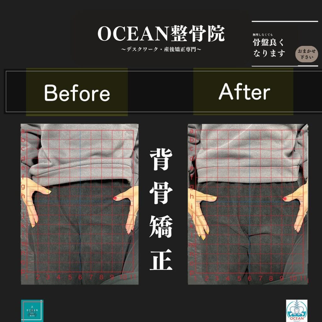 こんにちは！OCEAN整骨院です!当院で1番人気の背骨矯正です🦴「ボキッ」って音は怖い方も多いとは思いますが、基本的には全く痛くありません️どうしても怖くて力が入ってしまうと痛みを伴ってしまいます。
