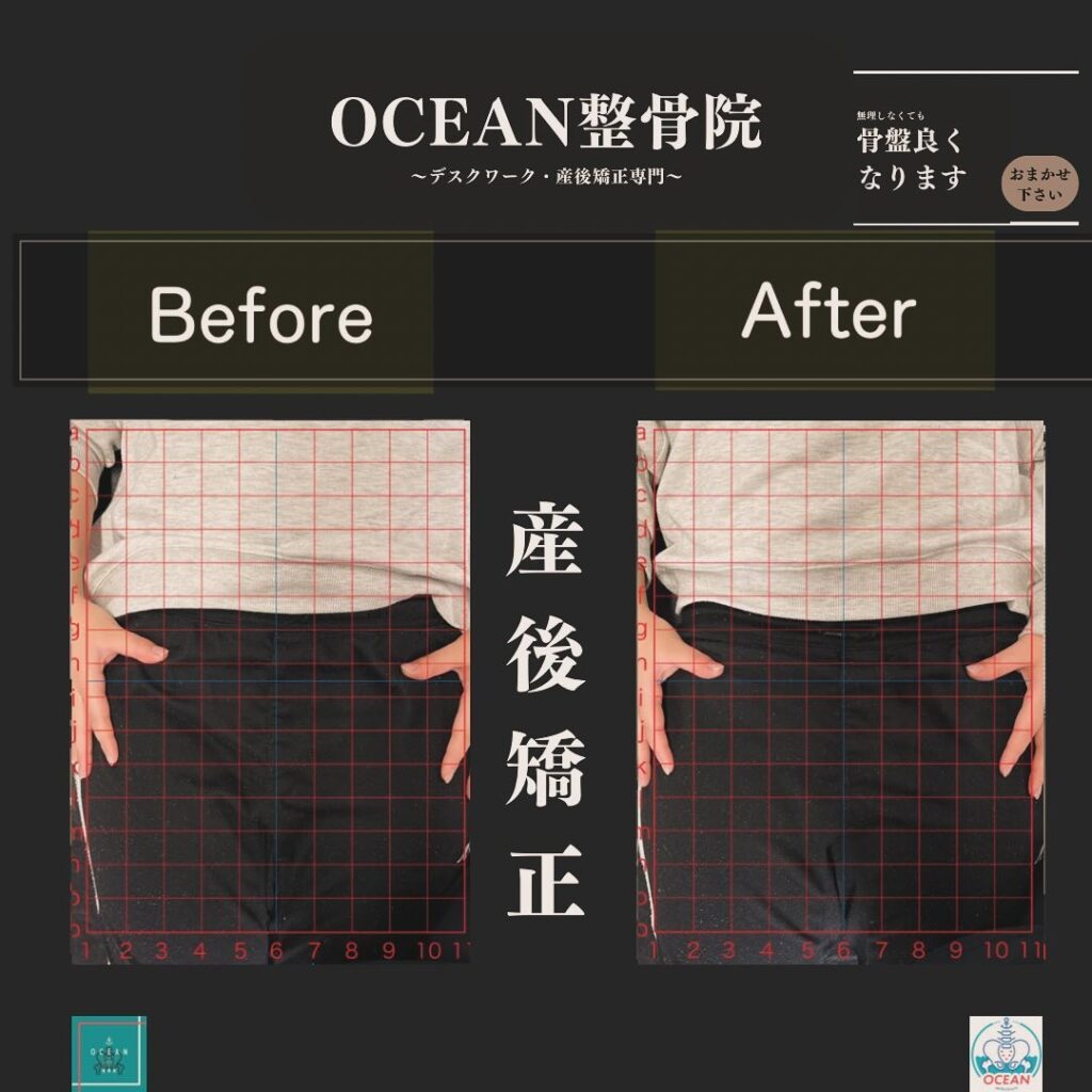 こんばんはOCEAN整骨院です！当院の産後矯正は様々な症状やお悩みに合わせた施術となっております…🤔💭家族や友達、仕事の上司、同期や後輩で体の不調でお困りの方がいらっしゃいましたら、是非ご紹介下さいきっとお力になれると思います🤝その他施術についてや、分からないこと等あればいつでもご連絡お待ちしております‍♂️‍♀️下記の時間を新規の方限定の時間帯にさせていただきます‍♀️①平日正午12:00~1名②平日午後18:00〜1名③土曜正午12:00〜1名④日曜正午12:00〜1名下記曜日、時間は産後の患者様優先時間となっております！○月曜日 9:00~13:00○金曜日9:00~13:00この時間でのご予約は託児スタッフが大事なお子様をお預かり致します※託児料は発生しません。