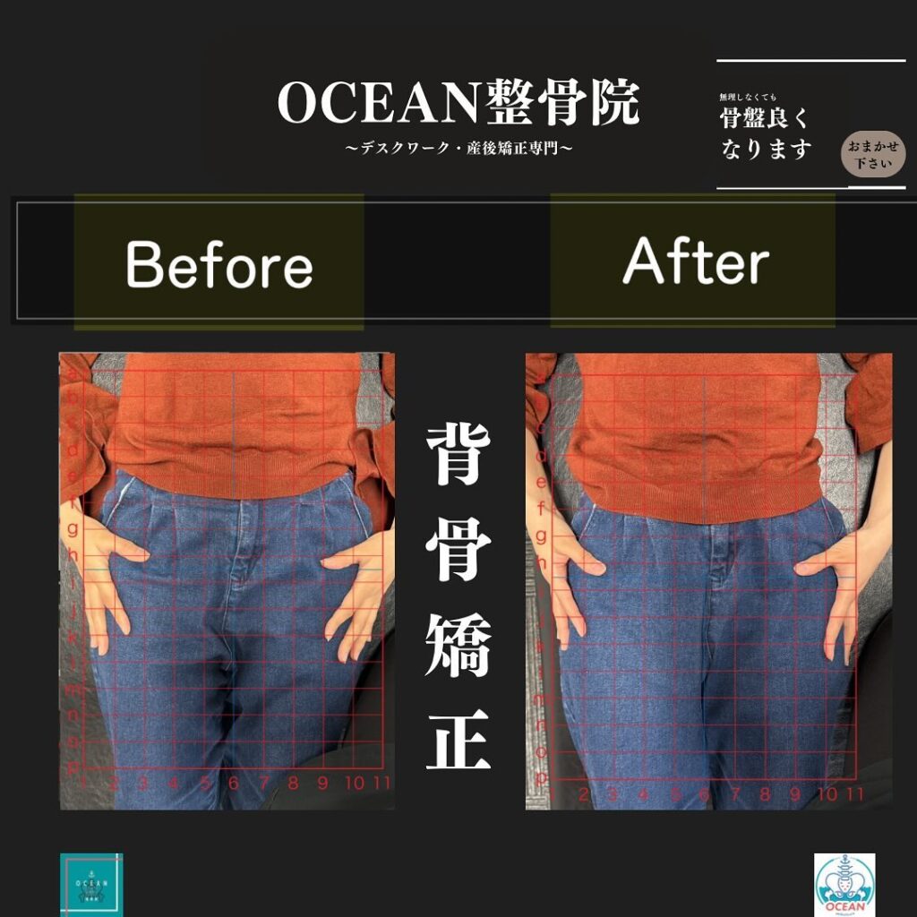 こんにちは！OCEAN整骨院です!当院で1番人気の背骨矯正です🦴「ボキッ」って音は怖い方も多いとは思いますが、基本的には全く痛くありません️どうしても怖くて力が入ってしまうと痛みを伴ってしまいます。