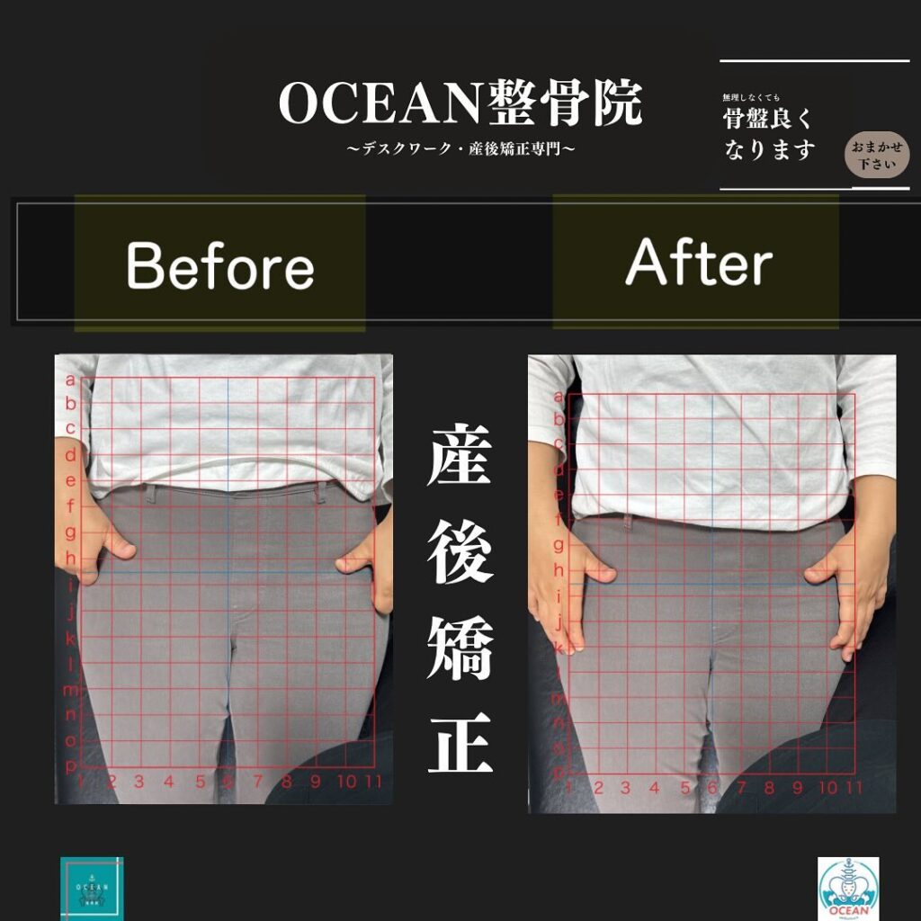 こんばんはOCEAN整骨院です！当院の産後矯正は様々な症状やお悩みに合わせた施術となっております…🤔💭家族や友達、仕事の上司、同期や後輩で体の不調でお困りの方がいらっしゃいましたら、是非ご紹介下さいきっとお力になれると思います🤝その他施術についてや、分からないこと等あればいつでもご連絡お待ちしております‍♂️‍♀️下記の時間を新規の方限定の時間帯にさせていただきます‍♀️①平日正午12:00~1名②平日午後18:00〜1名③土曜正午12:00〜1名④日曜正午12:00〜1名下記曜日、時間は産後の患者様優先時間となっております！○月曜日 9:00~13:00○金曜日9:00~13:00この時間でのご予約は託児スタッフが大事なお子様をお預かり致します※託児料は発生しません。