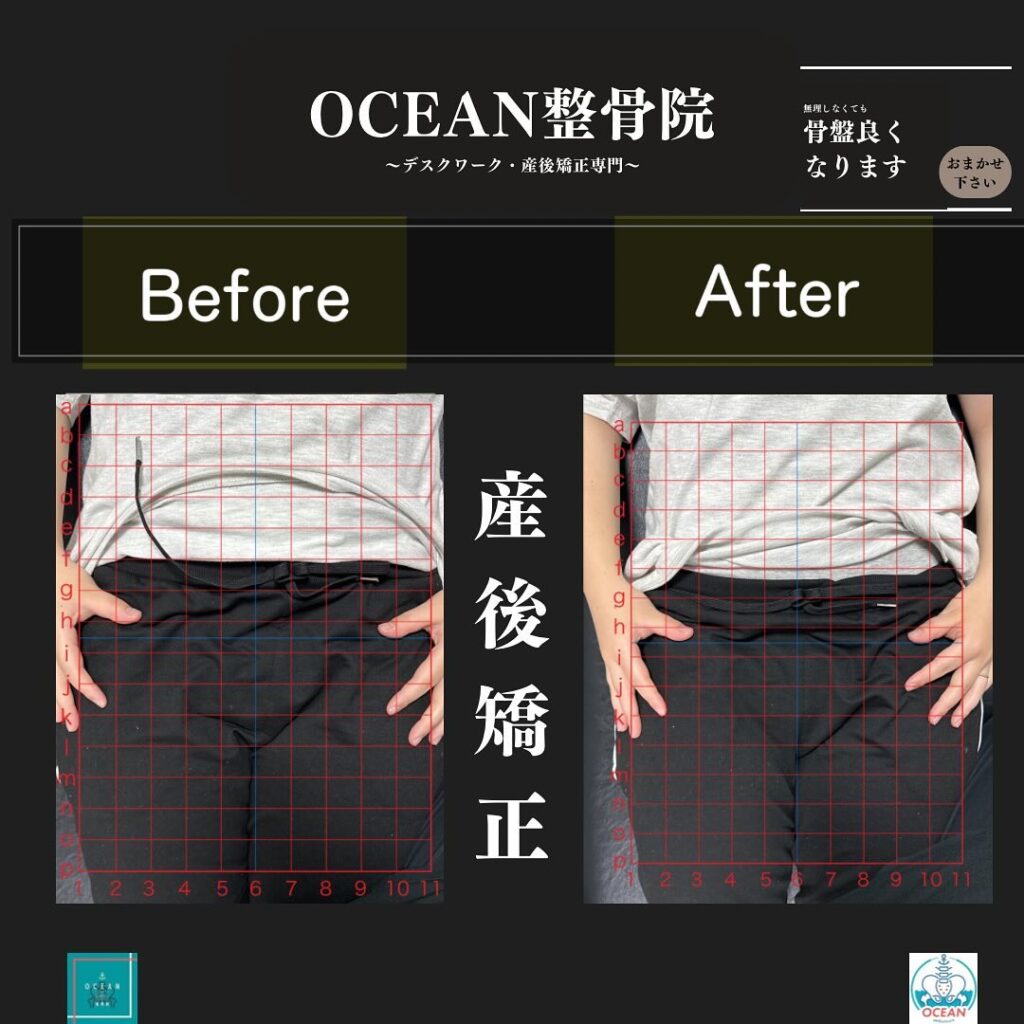 こんばんはOCEAN整骨院です！当院の産後矯正は様々な症状やお悩みに合わせた施術となっております…🤔💭家族や友達、仕事の上司、同期や後輩で体の不調でお困りの方がいらっしゃいましたら、是非ご紹介下さいきっとお力になれると思います🤝その他施術についてや、分からないこと等あればいつでもご連絡お待ちしております‍♂️‍♀️下記の時間を新規の方限定の時間帯にさせていただきます‍♀️①平日正午12:00~1名②平日午後18:00〜1名③土曜正午12:00〜1名④日曜正午12:00〜1名下記曜日、時間は産後の患者様優先時間となっております！○月曜日 9:00~13:00○金曜日9:00~13:00この時間でのご予約は託児スタッフが大事なお子様をお預かり致します※託児料は発生しません。