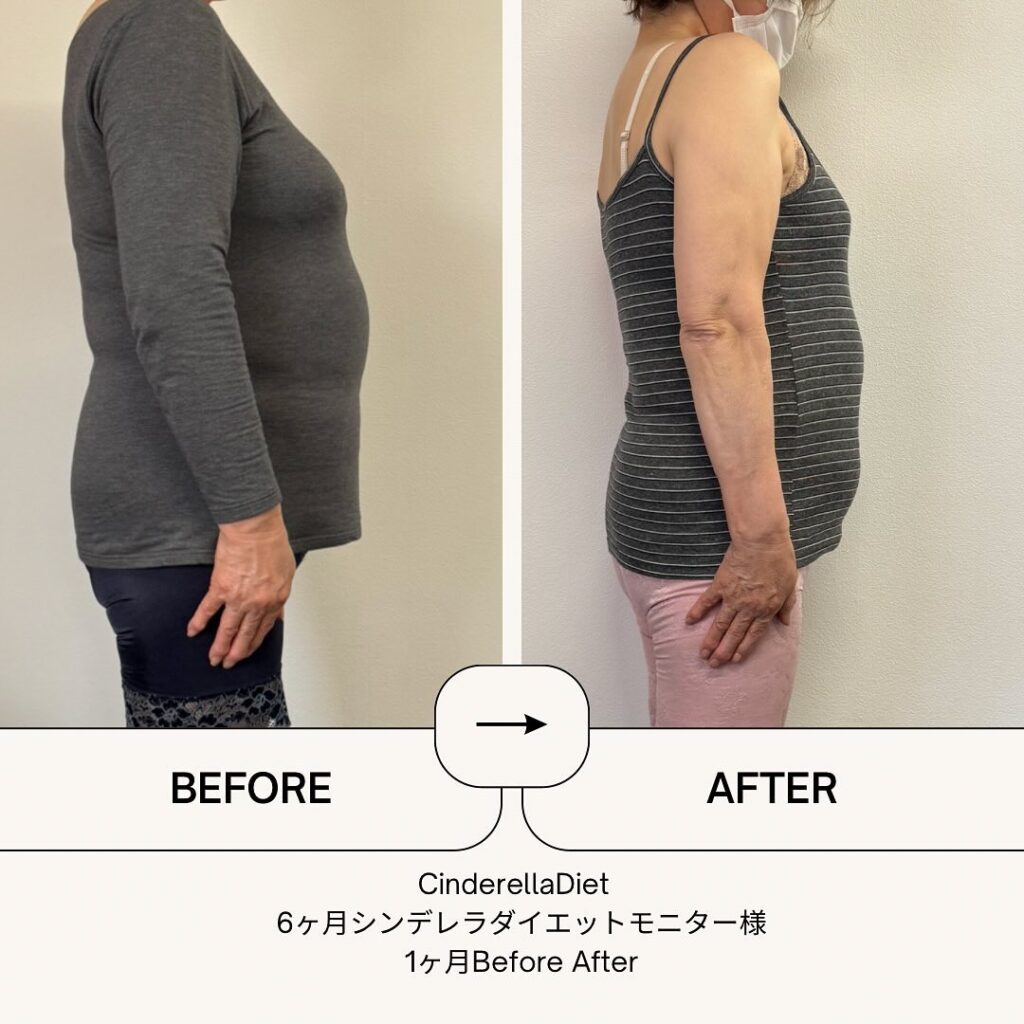 【1ヶ月経過Before After】3ヶ月コースのお客様の比較画像になります️1ヶ月で、体重・・・-4.5kg。