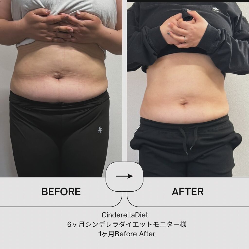【1ヶ月経過Before After】6ヶ月コースのお客様の比較画像になります️1ヶ月で、体重・・・-7.9kg。