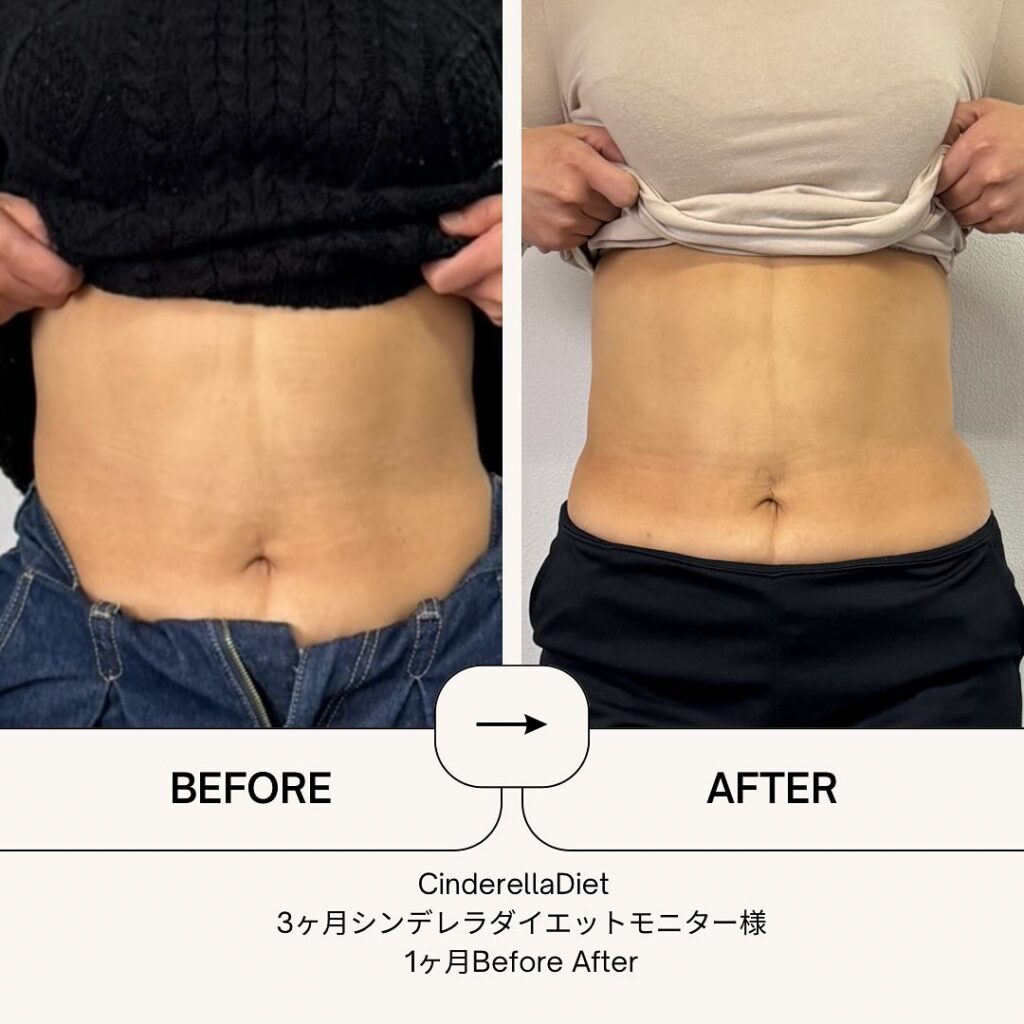 【1ヶ月経過Before After】3ヶ月コースのお客様の比較画像になります️1ヶ月で、体重・・・-4.8kg。