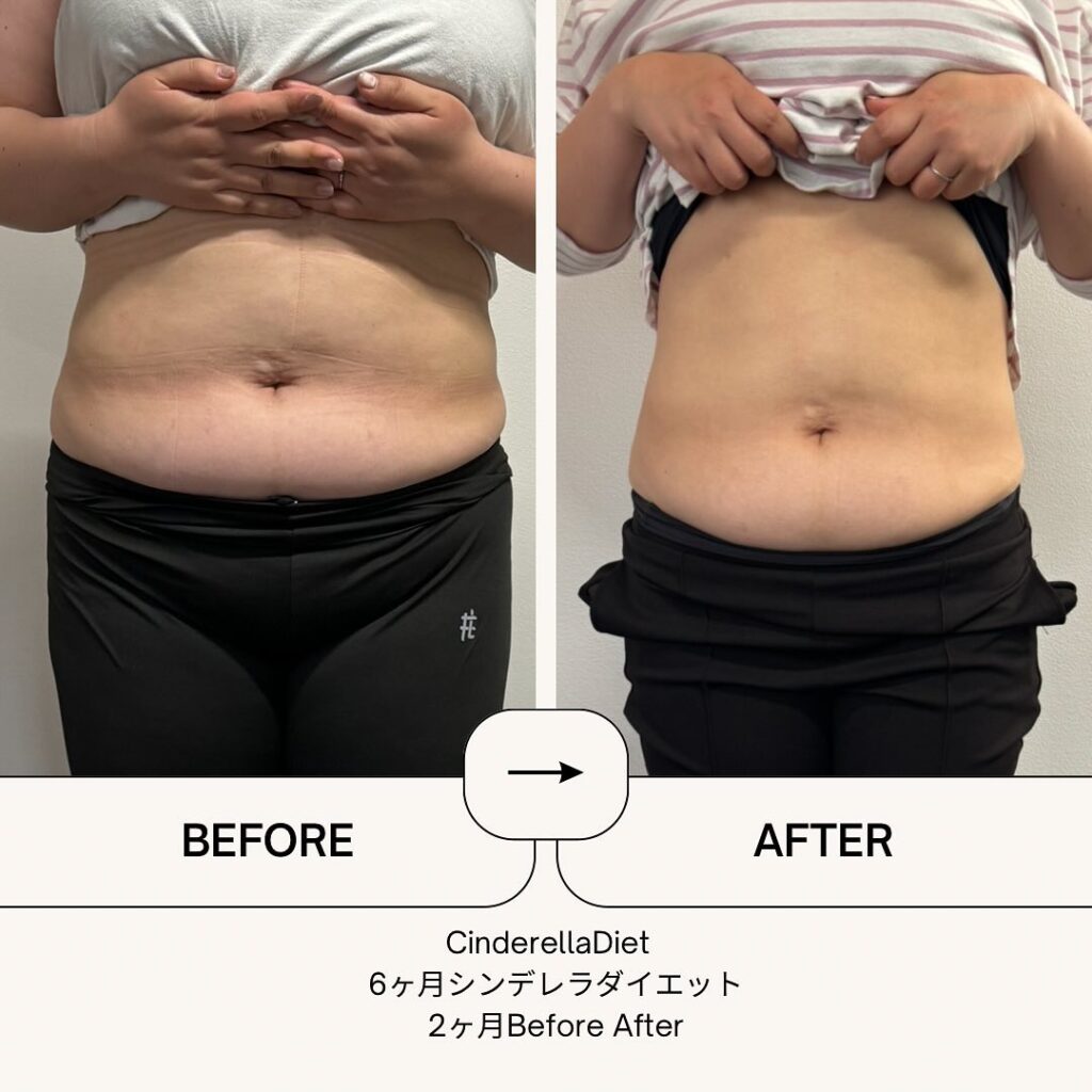 【2ヶ月経過Before After】6ヶ月コースのお客様の比較画像になります️2ヶ月で、体重・・・-10.9kg。