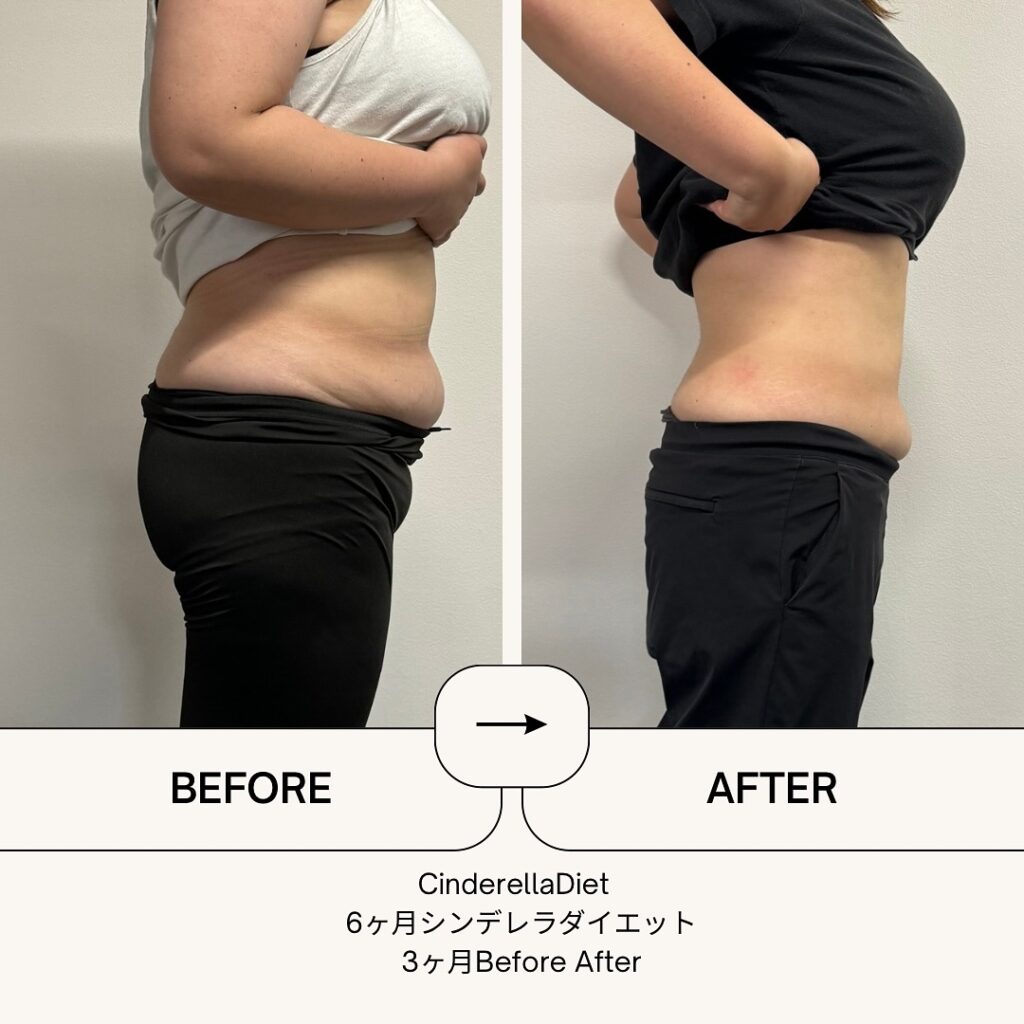 【3ヶ月経過Before After】6ヶ月コースのお客様の比較画像になります️3ヶ月で、体重・・・-12kg。