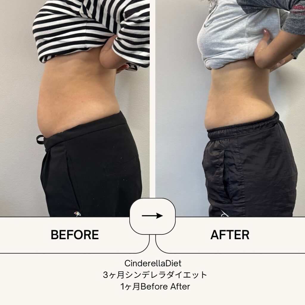 【1ヶ月経過Before After】3ヶ月コースのお客様の比較画像になります️1ヶ月で、体重・・・-6kg。