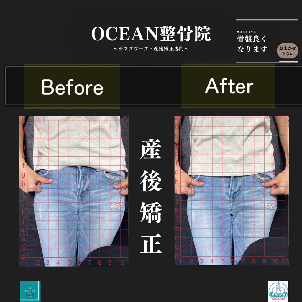 OCEAN整骨院では産後矯正、猫背矯正、骨盤矯正、背骨矯正、疼痛特化整体、シンデレラダイエットなどの豊富な施術であなたの悩みの解決をお手伝い致します‍♂️‍♀️「産後の骨盤を整えたい！」「結婚式までに絶対に痩せたい！」「あのころの服をもう一度着たい！」「猫背を治したい」「人生を変えたい！」と本気で体の不調改善を徹底的に全力でサポート致します‍♀️またシンデレラダイエットは、〇分子栄養学に基づく食事指導〇高品質のサプリメント〇ハイブリッドトレーニング〇遺伝子検査によるダイエットの効率化〇特殊クリームによる痩身施術この5つの柱で、理想の体重･体型を目指すダイエットとなっております。