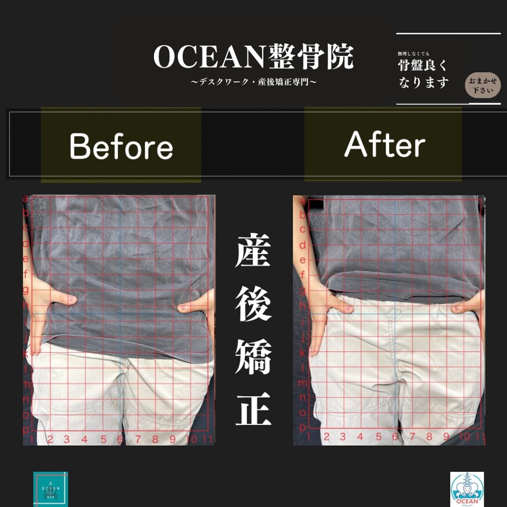 OCEAN整骨院では産後矯正、猫背矯正、骨盤矯正、背骨矯正、疼痛特化整体、シンデレラダイエットなどの豊富な施術であなたの悩みの解決をお手伝い致します‍♂️‍♀️「産後の骨盤を整えたい！」「結婚式までに絶対に痩せたい！」「あのころの服をもう一度着たい！」「猫背を治したい」「人生を変えたい！」と本気で体の不調改善を徹底的に全力でサポート致します‍♀️またシンデレラダイエットは、〇分子栄養学に基づく食事指導〇高品質のサプリメント〇ハイブリッドトレーニング〇遺伝子検査によるダイエットの効率化〇特殊クリームによる痩身施術この5つの柱で、理想の体重･体型を目指すダイエットとなっております。