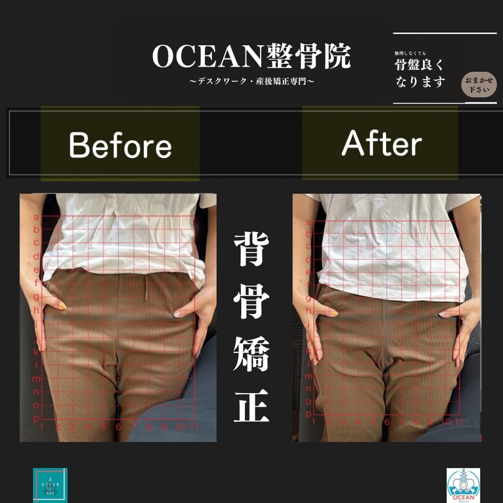 OCEAN整骨院では産後矯正、猫背矯正、骨盤矯正、背骨矯正、疼痛特化整体、シンデレラダイエットなどの豊富な施術であなたの悩みの解決をお手伝い致します‍♂️‍♀️「産後の骨盤を整えたい！」「結婚式までに絶対に痩せたい！」「あのころの服をもう一度着たい！」「猫背を治したい」「人生を変えたい！」と本気で体の不調改善を徹底的に全力でサポート致します‍♀️またシンデレラダイエットは、〇分子栄養学に基づく食事指導〇高品質のサプリメント〇ハイブリッドトレーニング〇遺伝子検査によるダイエットの効率化〇特殊クリームによる痩身施術この5つの柱で、理想の体重･体型を目指すダイエットとなっております。