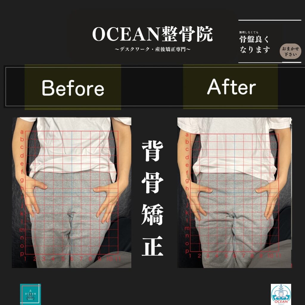 OCEAN整骨院では産後矯正、猫背矯正、骨盤矯正、背骨矯正、疼痛特化整体、シンデレラダイエットなどの豊富な施術であなたの悩みの解決をお手伝い致します‍♂️‍♀️「産後の骨盤を整えたい！」「結婚式までに絶対に痩せたい！」「あのころの服をもう一度着たい！」「猫背を治したい」「人生を変えたい！」と本気で体の不調改善を徹底的に全力でサポート致します‍♀️またシンデレラダイエットは、〇分子栄養学に基づく食事指導〇高品質のサプリメント〇ハイブリッドトレーニング〇遺伝子検査によるダイエットの効率化〇特殊クリームによる痩身施術この5つの柱で、理想の体重･体型を目指すダイエットとなっております。