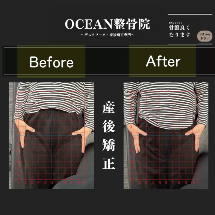 【骨盤の歪み、放置してませんか？】 産後のママさん、こんな症状ありませんか？  腰が痛くて長時間抱っこがつらい…  産前のズボンがきつい  姿勢が崩れて猫背が気になるOCEAN整骨院なら  産後の骨盤ケア・姿勢改善・ダイエットをサポート！  託児付き施術でママも安心‍♀️  土曜・祝日も営業だから忙しい方も◎「痛みがなくなった！」「ズボンがスッキリ履けるように！」 ️ 喜びの声多数 施術のビフォーアフターは投稿をチェック ご予約・ご相談はDMまたはLINEから  詳しくはプロフィールのリンクへ！